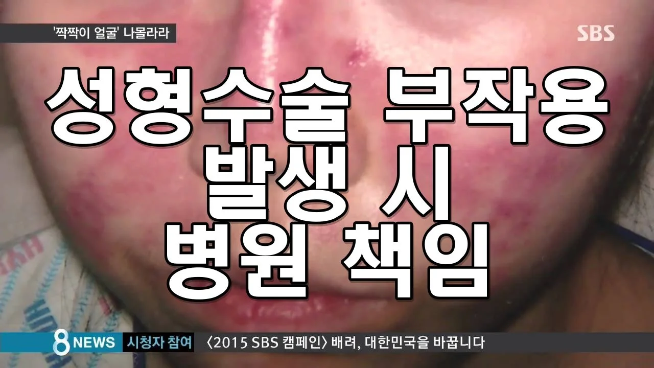 성형수술 부작용 발생 시 병원 책임