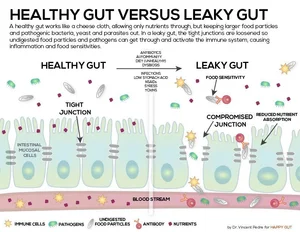 How to Heal a Leaky Gut Naturally — Magnolia Wellness