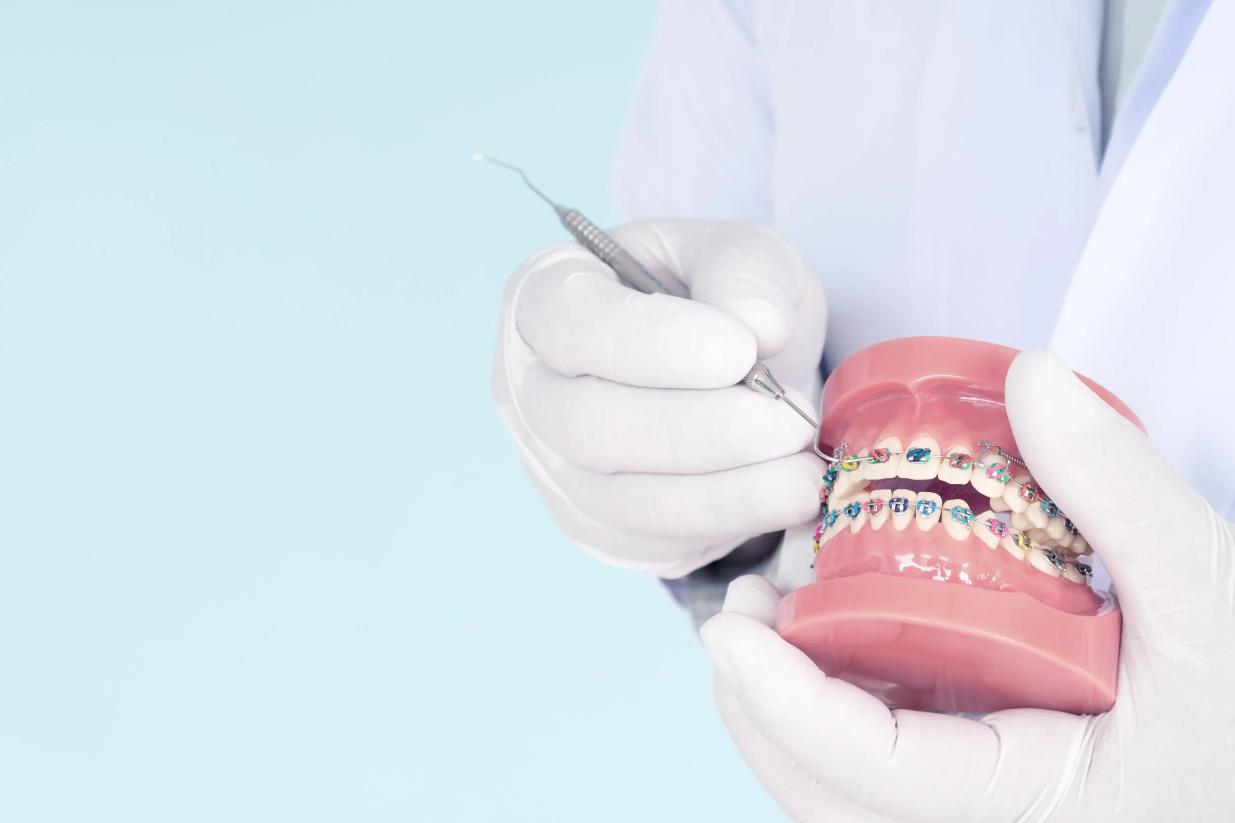 Cari Behel Ortho Murah di Surabaya? Ini Tips Memilih Yang Tepat untuk Gigi Sehat