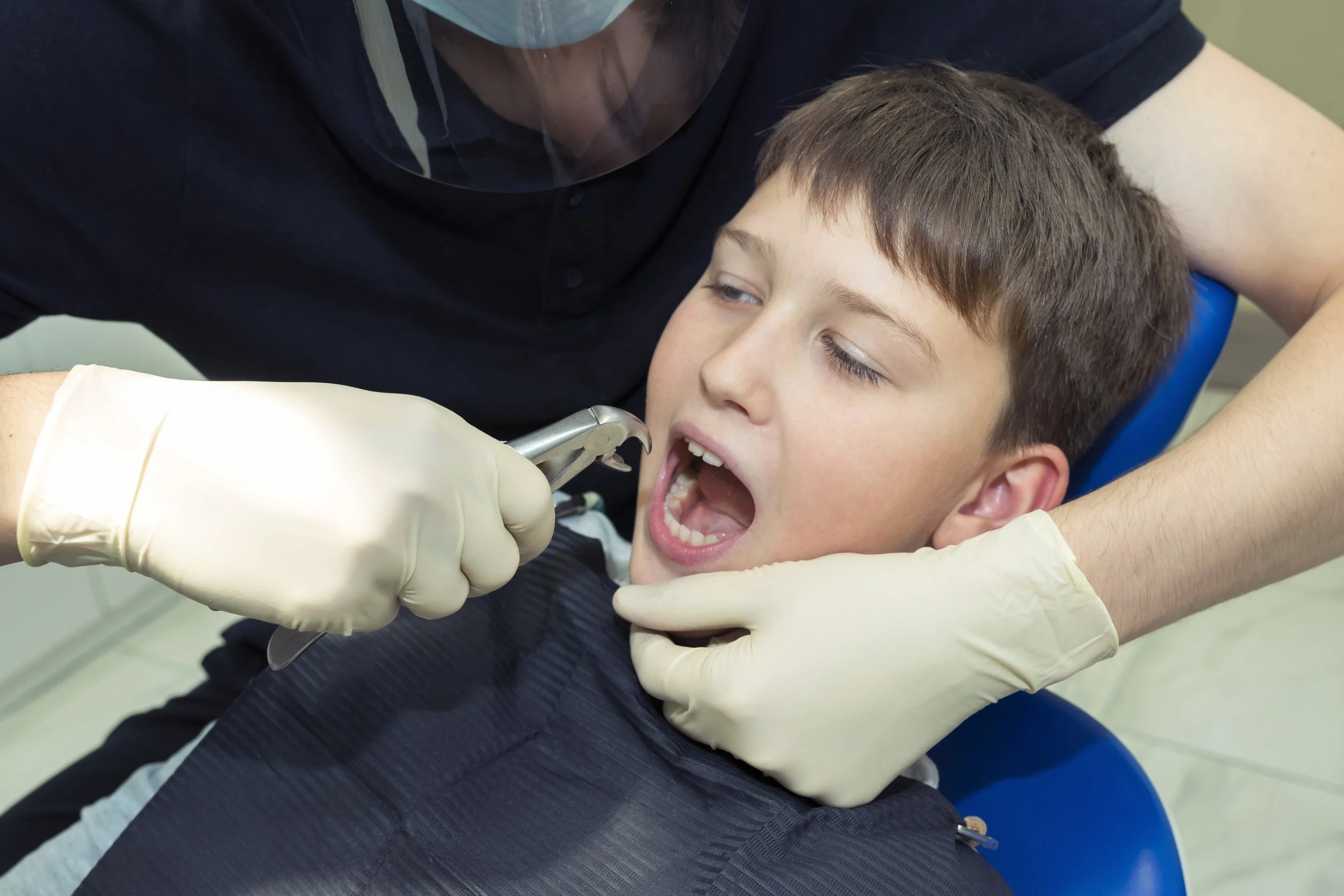 Cabut Gigi Anak Surabaya Kini Nggak Perlu Bikin Cemas, Ada banyak Klinik Gigi Ramah Anak!