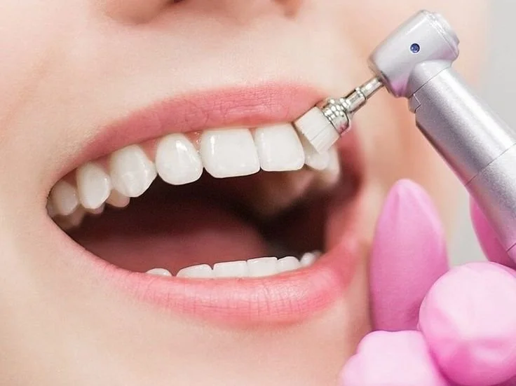 Gigi Kuning dan Kusam? Ini Penyebab dan Cara Merawatnya