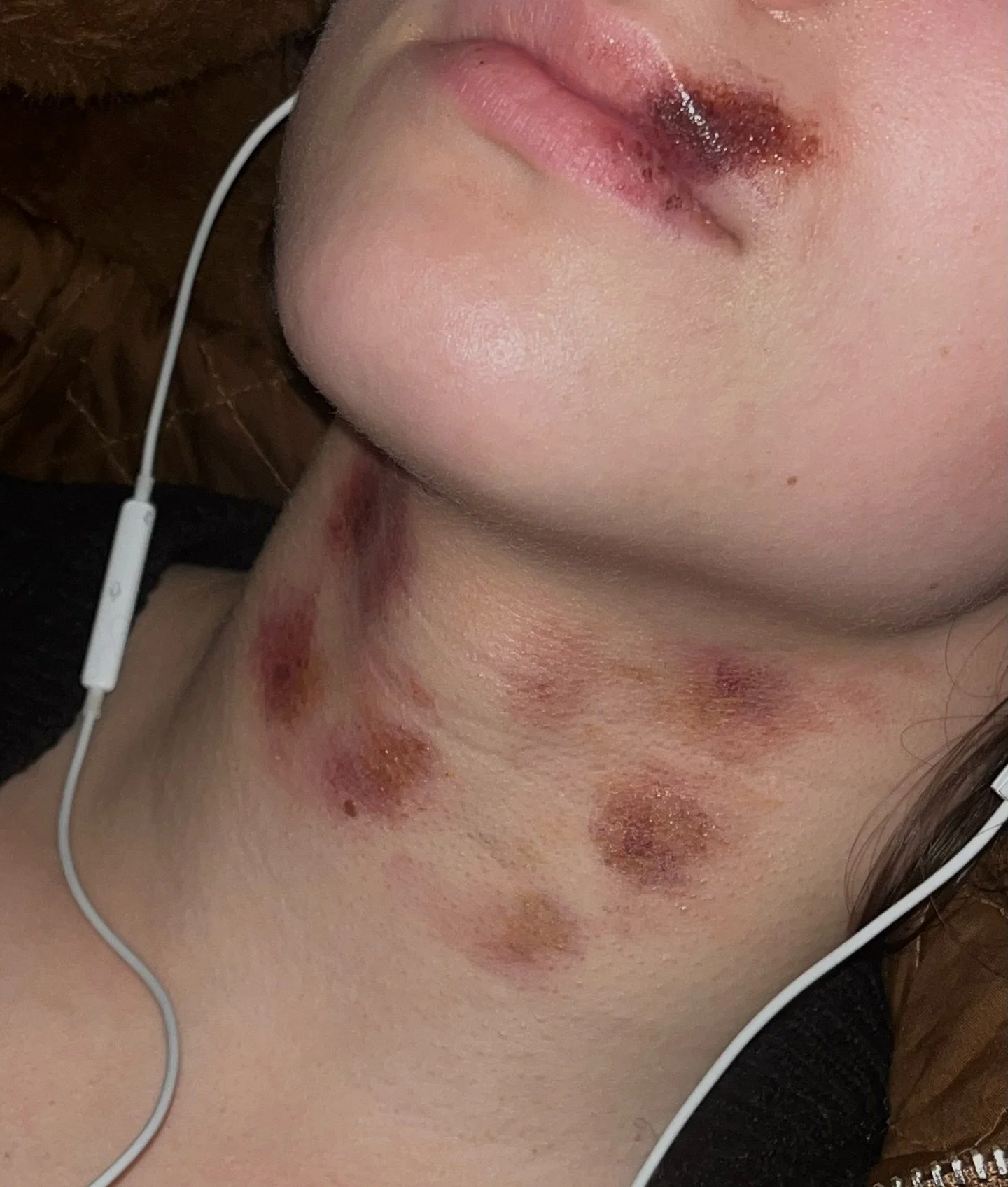 bruises on Ines Del Valle @idelvalle592 for &ldquo;Les profondeurs d&rsquo;un cri&rdquo; written and direct by @micheledera 

&hellip;.. 

chef op&eacute;rateur - @raphael.moli 
assistante r&eacute;al- @margot.volodia 
directrice de prod - @agathe.de