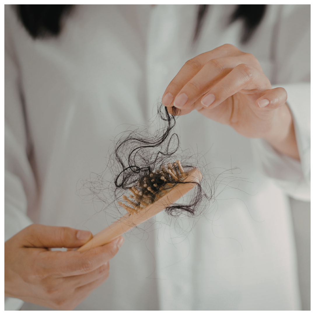 diagnóstico como en el tratamiento médico y quirúrgico de todas las formas de alopecia y trastornos capilares en hombres y mujeres. 