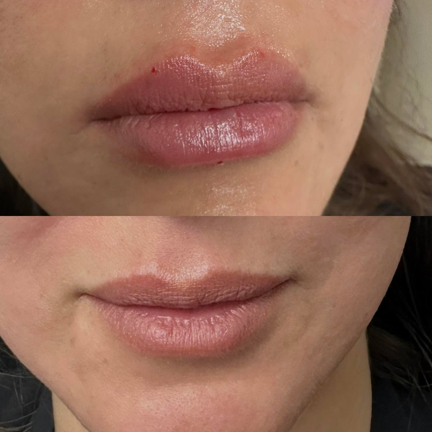 Luxury lips with 1 syringe of Juvederm by Rawaa 💉
Naturally plumped for a soft, balanced finish.

Did you know at Blue Rose Salon &amp; Spa we also offer injectables? Our highly skilled and trained medical aesthetician Rawaa is in the salon &amp; sp