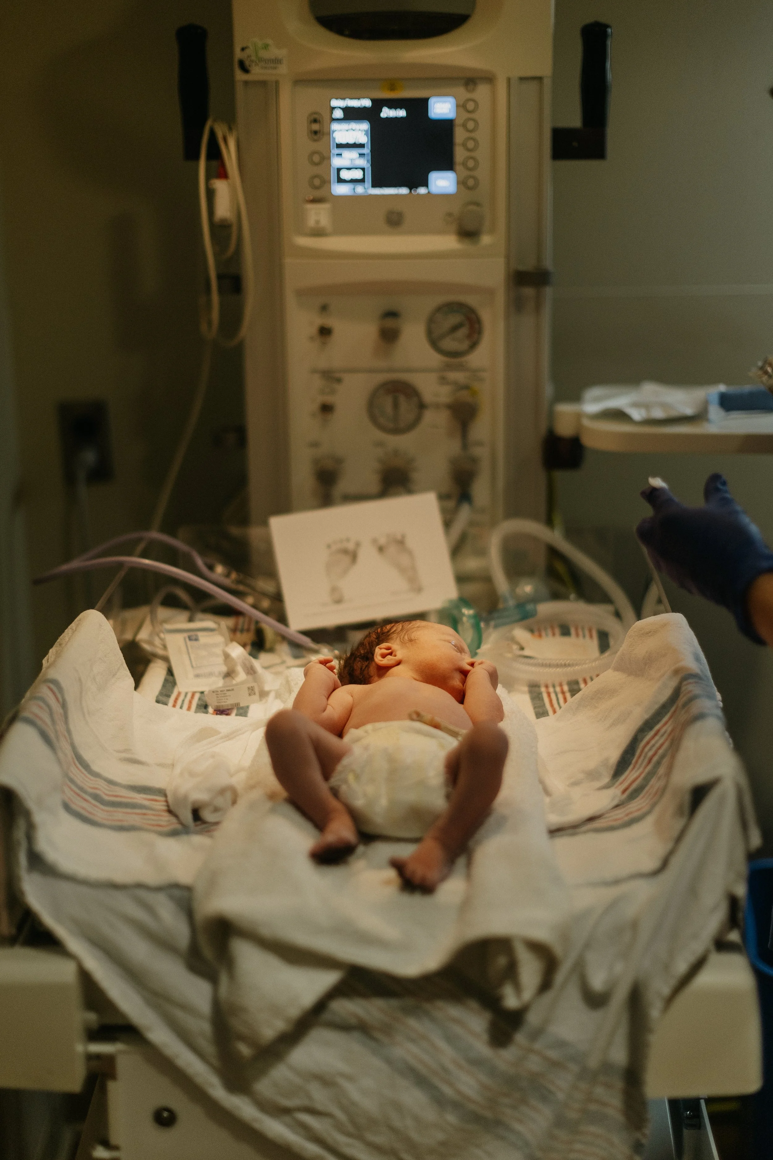 A newborn baby lying on a hospital bassinet with medical equipment and monitors in the background.