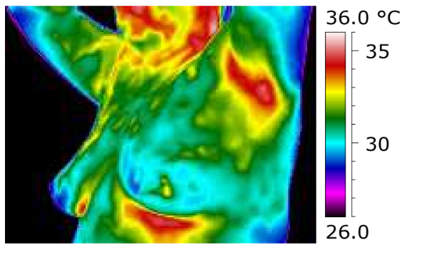 Infrared thermal image of a human face showing different temperature areas, with a color scale from 26°C to 36°C.