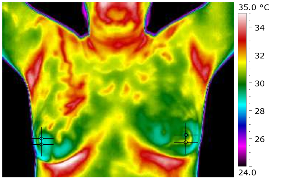 Infrared thermal image of a human upper torso showing temperature variations, with a temperature scale from 24°C to 35°C on the right.