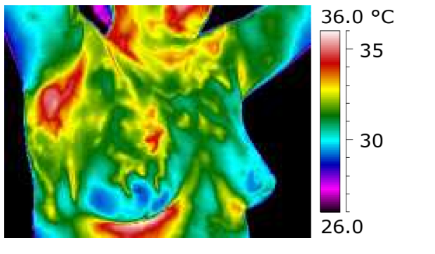 Thermal image of a person's face showing temperature variations, with a color scale from 26°C to 36°C.