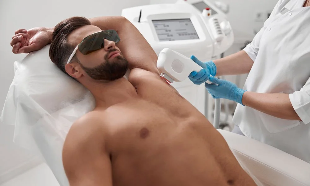 Laser hair removal for men