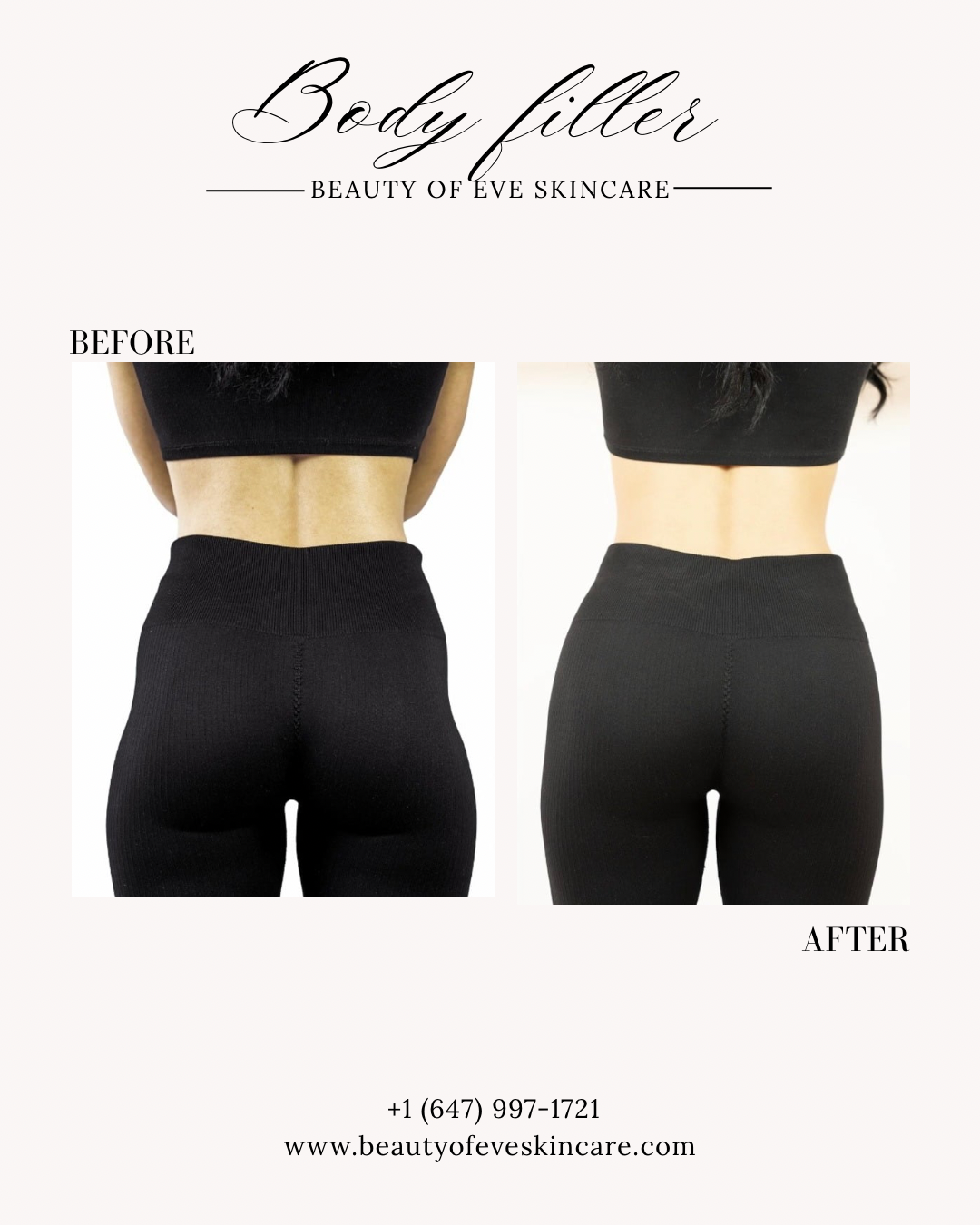 Copy of Copy of Copy of Body filler result.png
