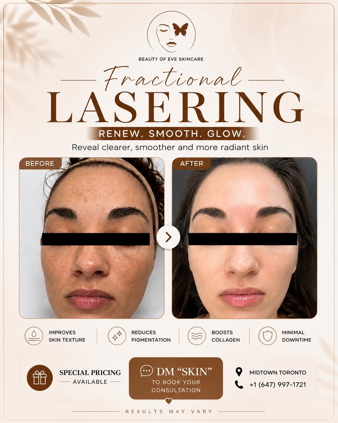 Tired of pigmentation, uneven skin, or dull texture?

This is your sign.

✨ Fractional Laser = real skin change
✔️ Smoother texture
✔️ Brighter, even tone
✔️ Visible results you can feel

No filters. No covering up. Just better skin.

📍 Midtown Toro