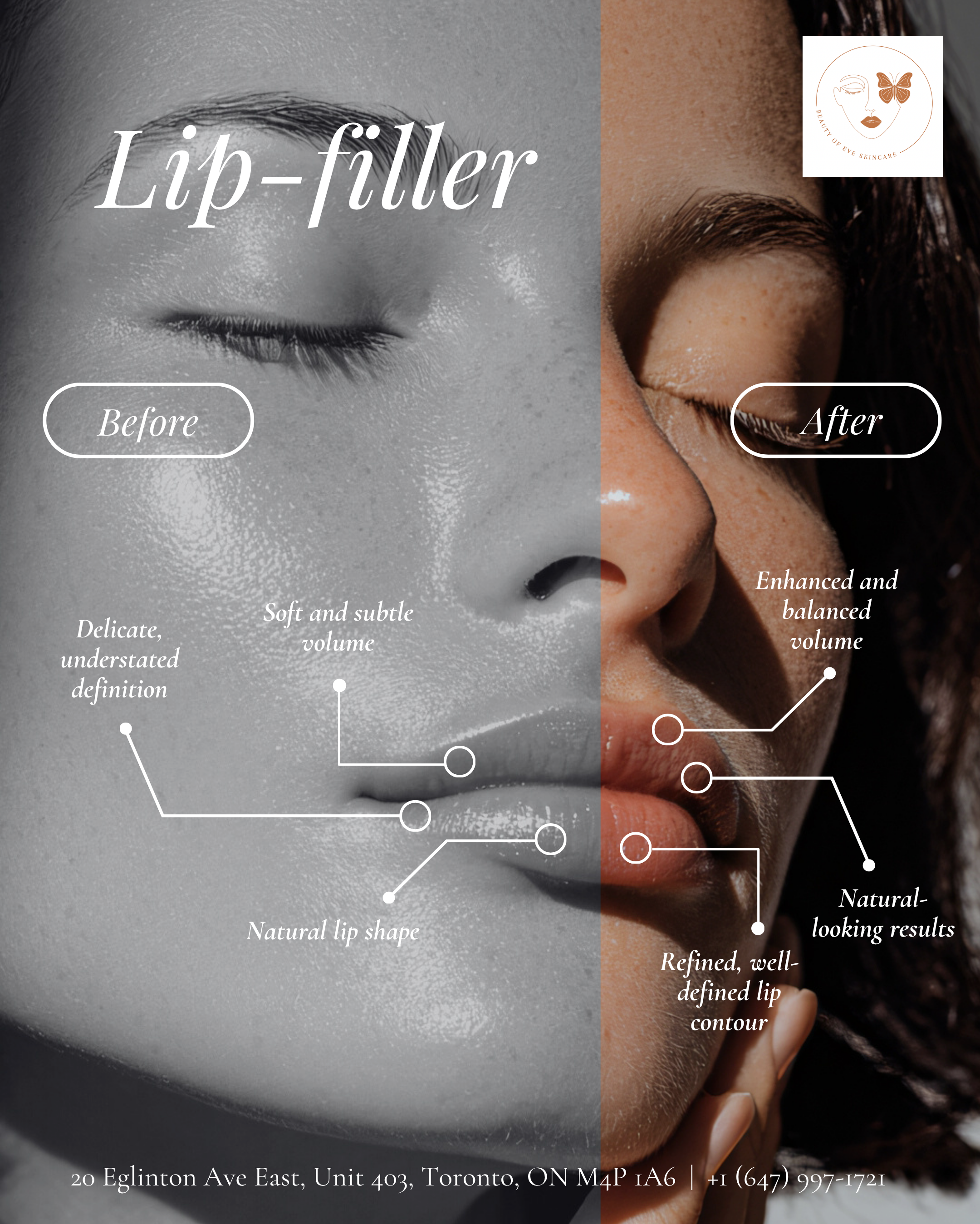 Tired of thin or uneven lips?