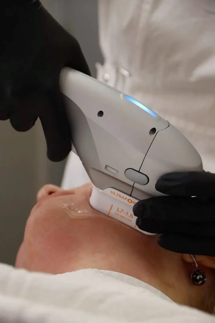 HIFU skin tightening treatment on the jawline