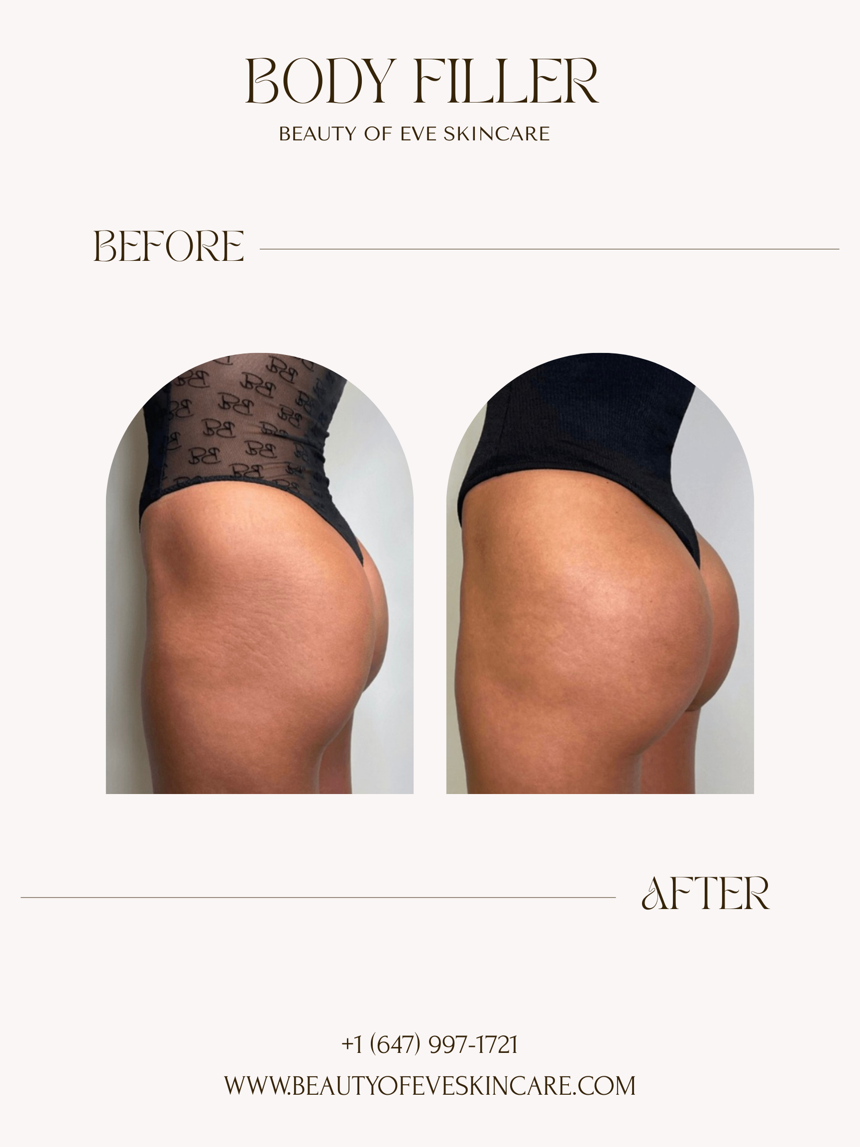 Copy of Body filler.png.png