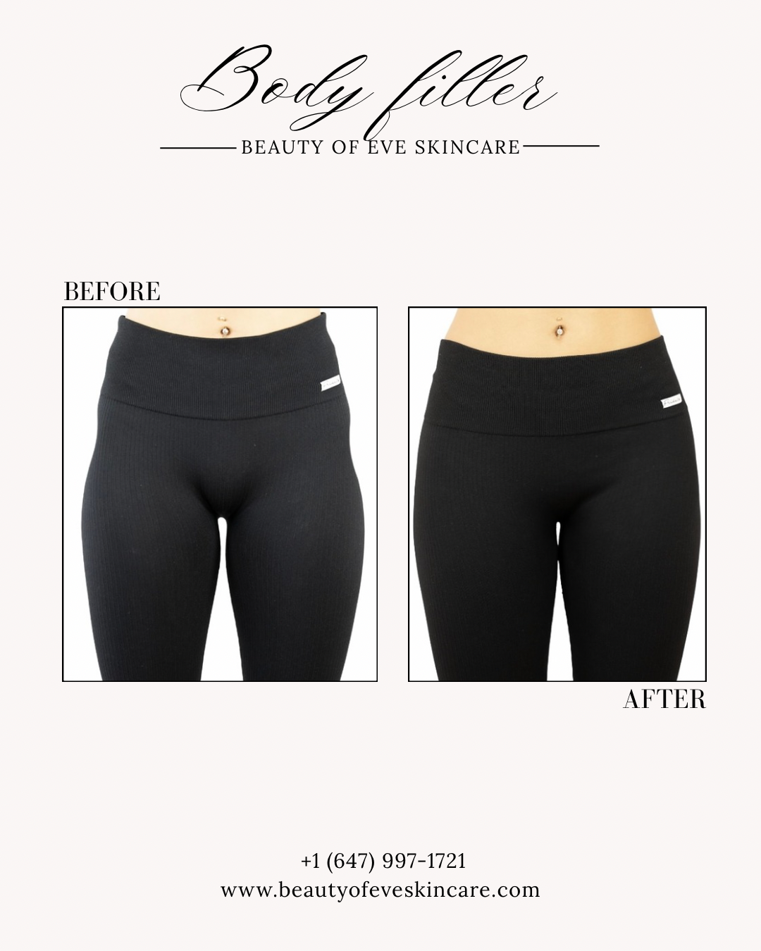 Copy of Body filler result.png