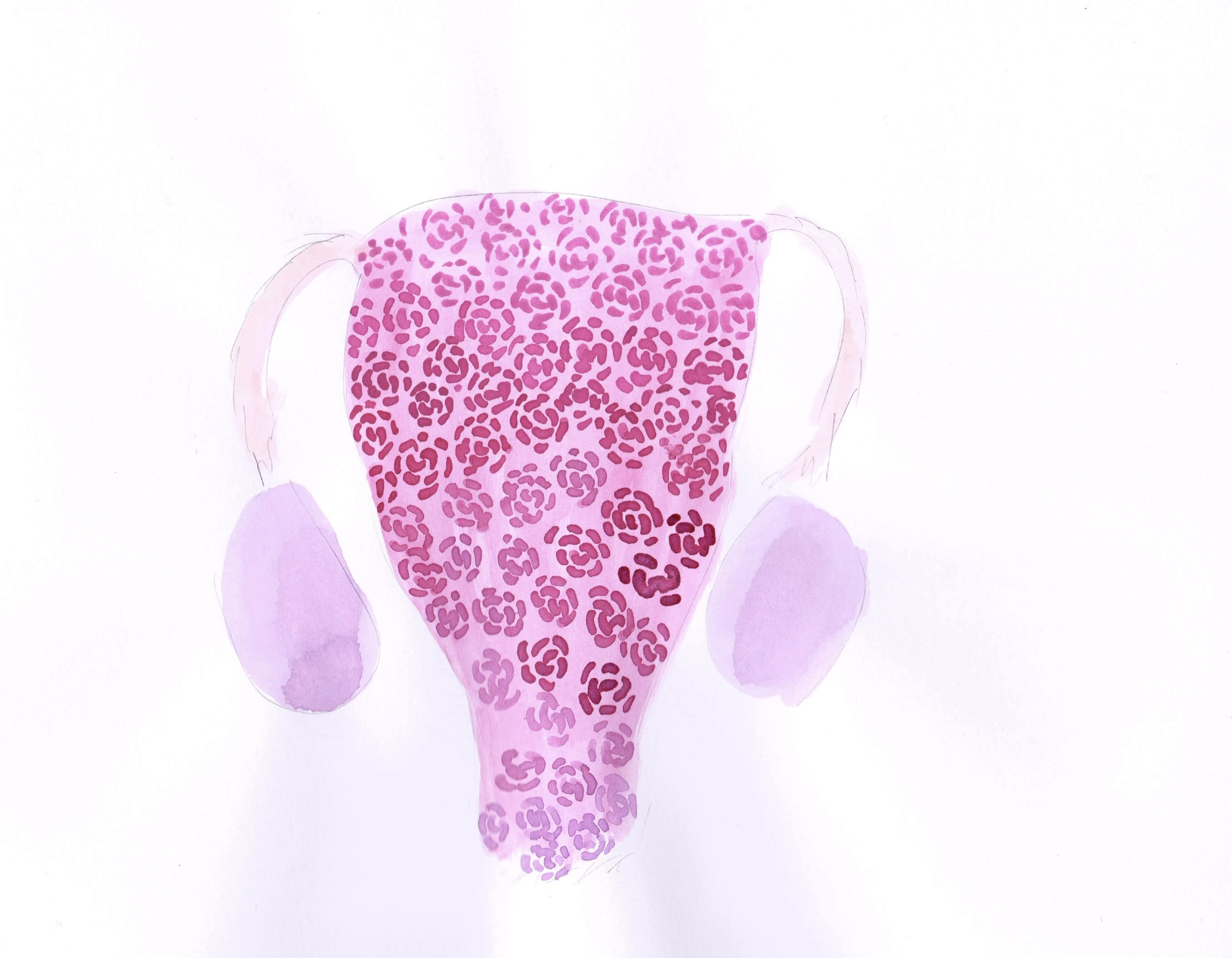 Womb art 1142926 2.jpg