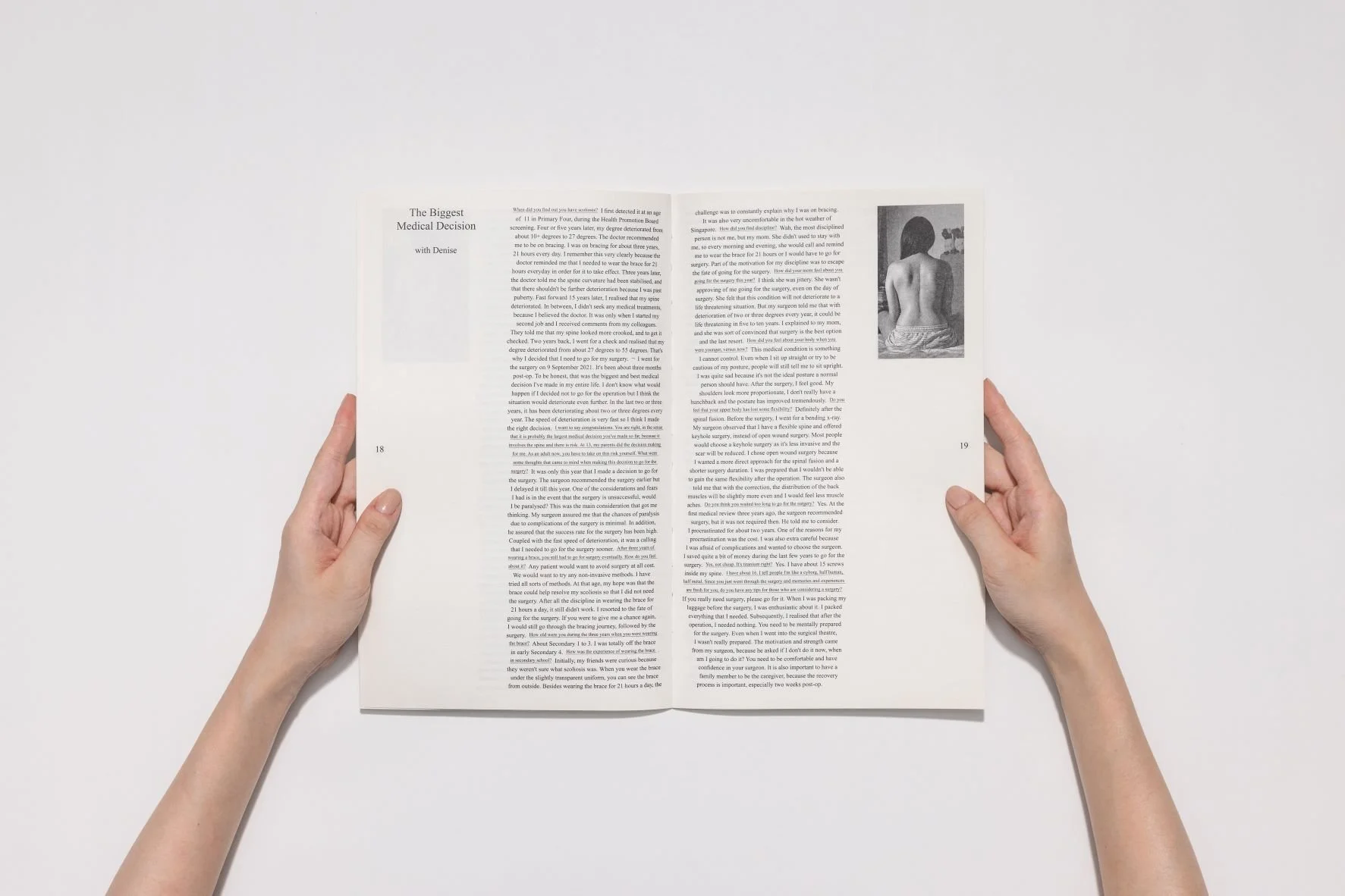 A spread from the photobook rules for photographing a scoliotic patient, published by THEBOOKSHOW and designed by Macarius Eng. Image courtesy of Macarius Eng.