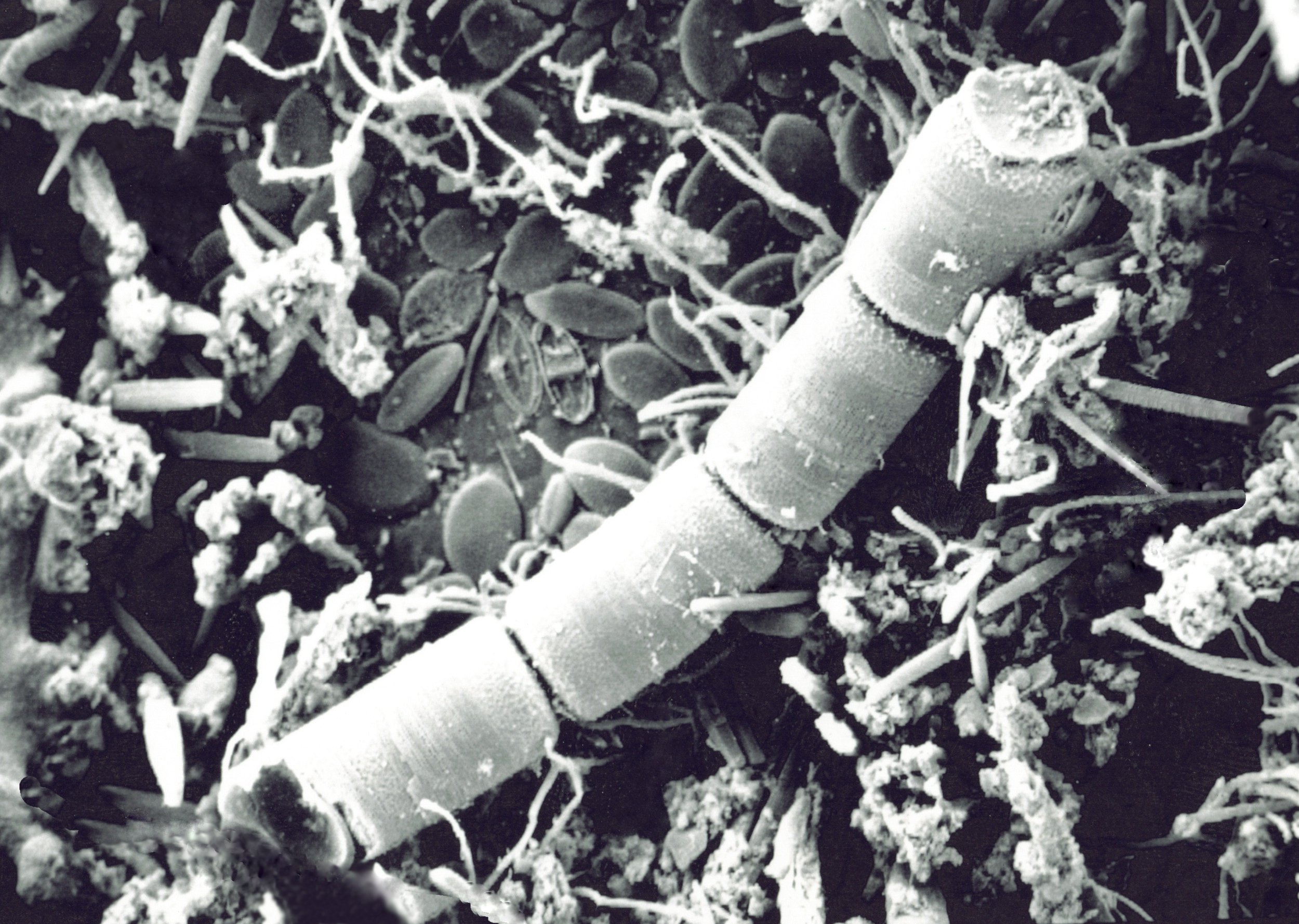 Diatom Filaments