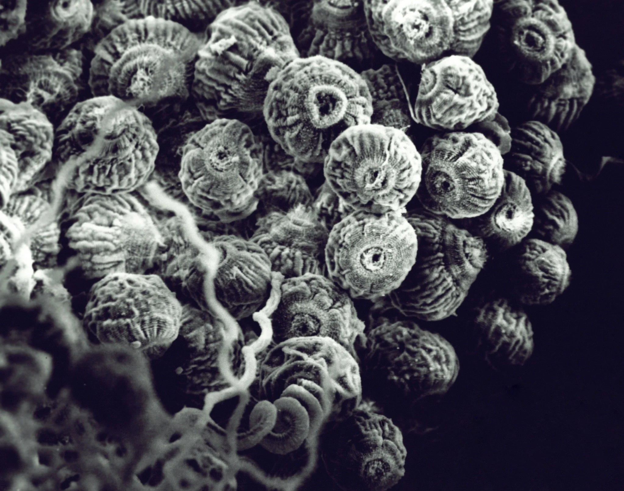 Colonial Ciliates