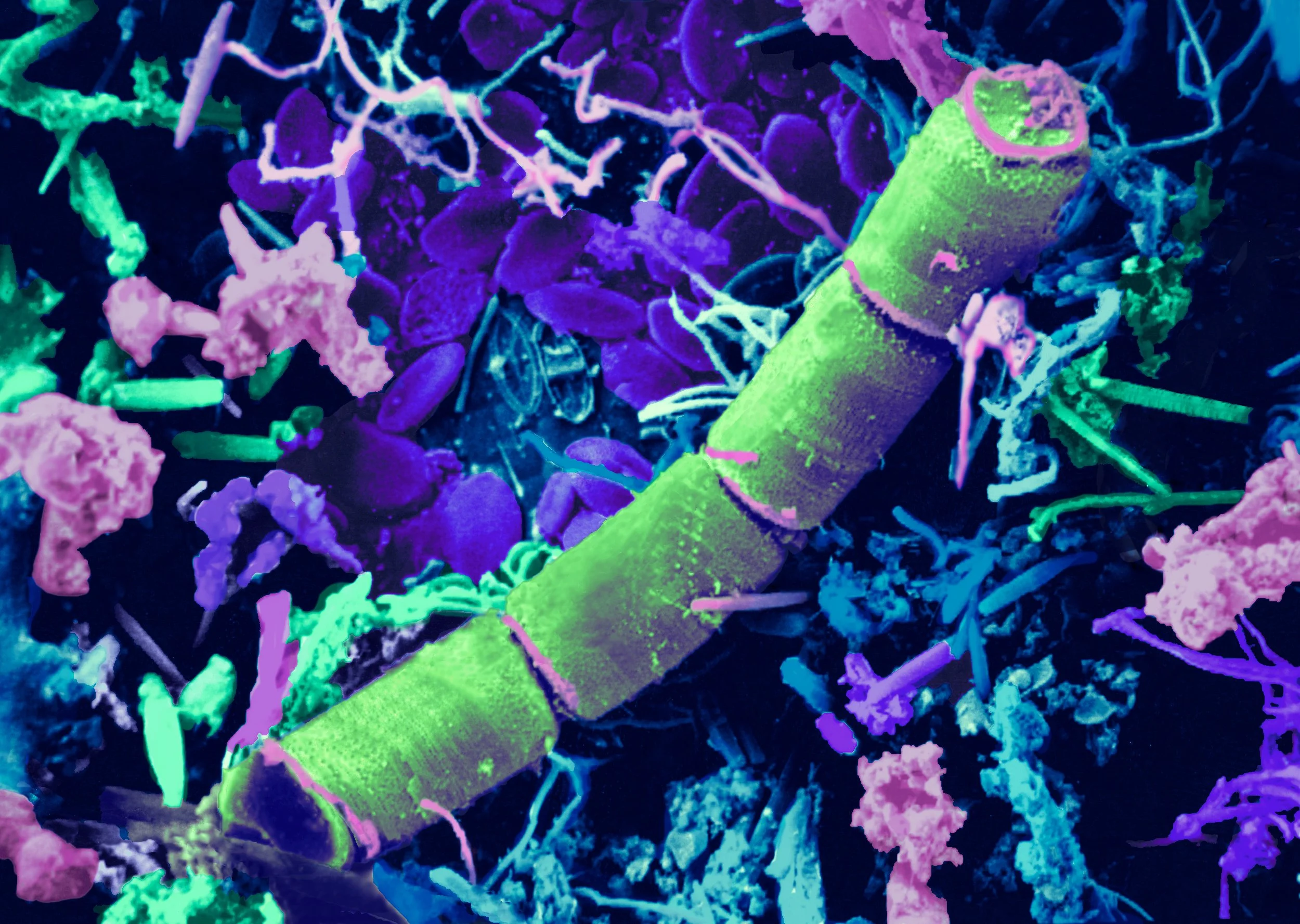 Diatom Filaments colorized