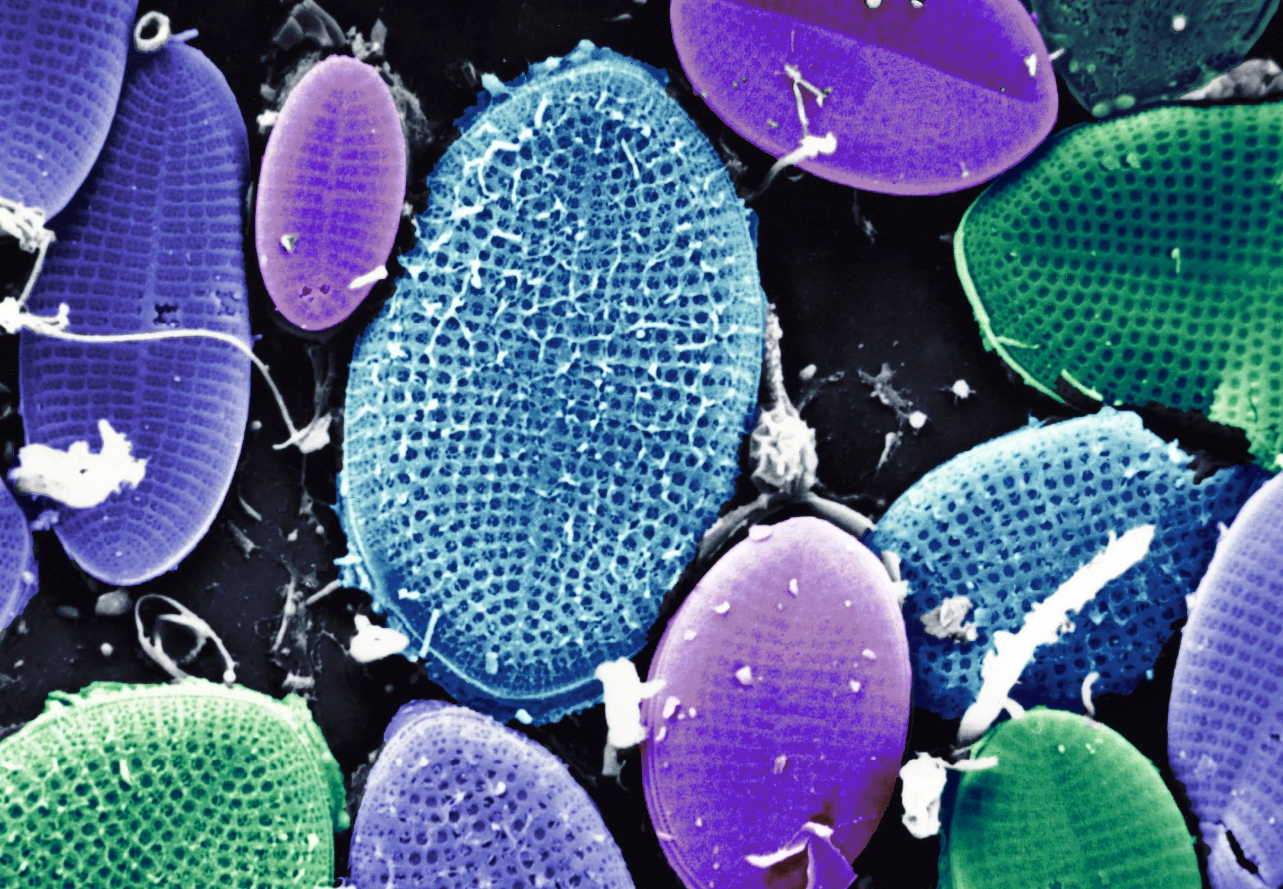 Diatoms colorized