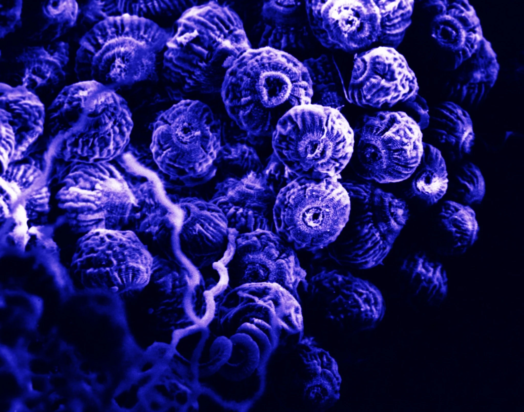 Colonial Ciliates colorized
