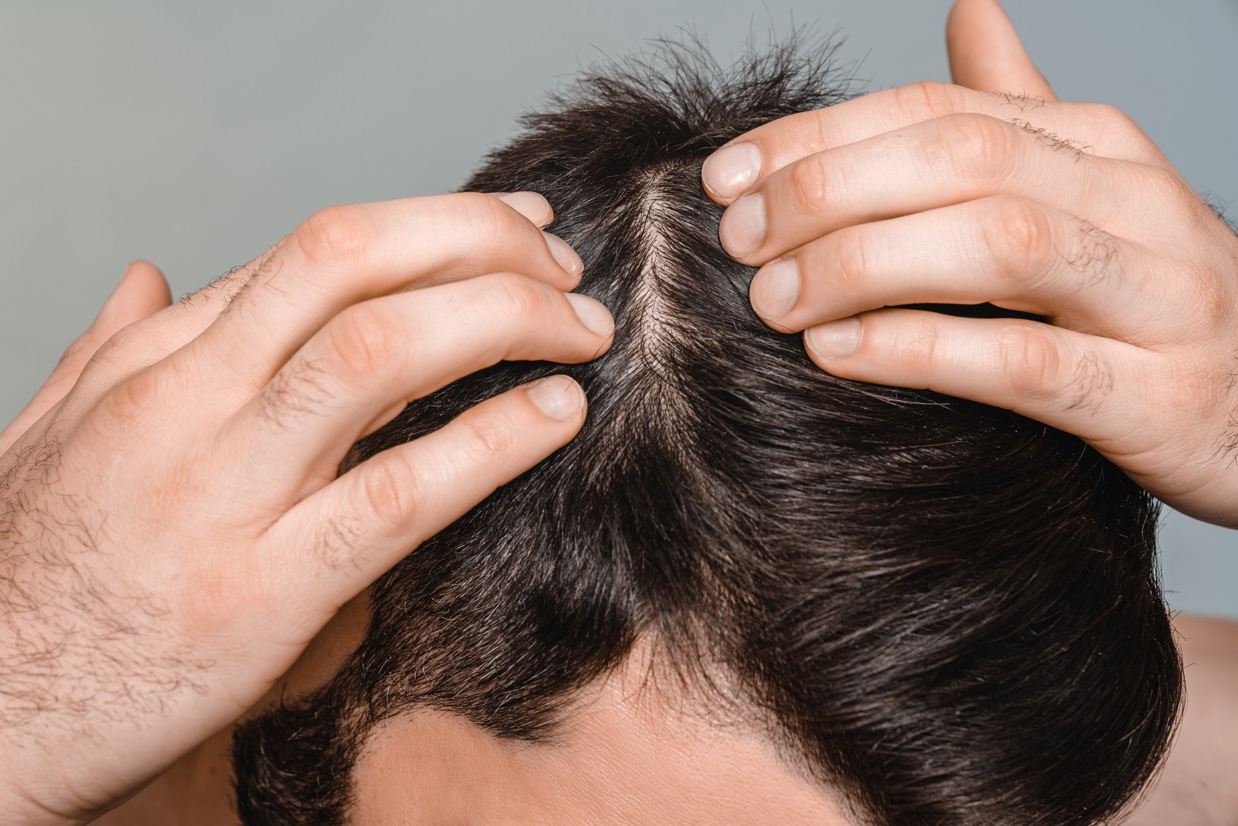 Why Scalp Health Is the Foundation of Healthy Hair