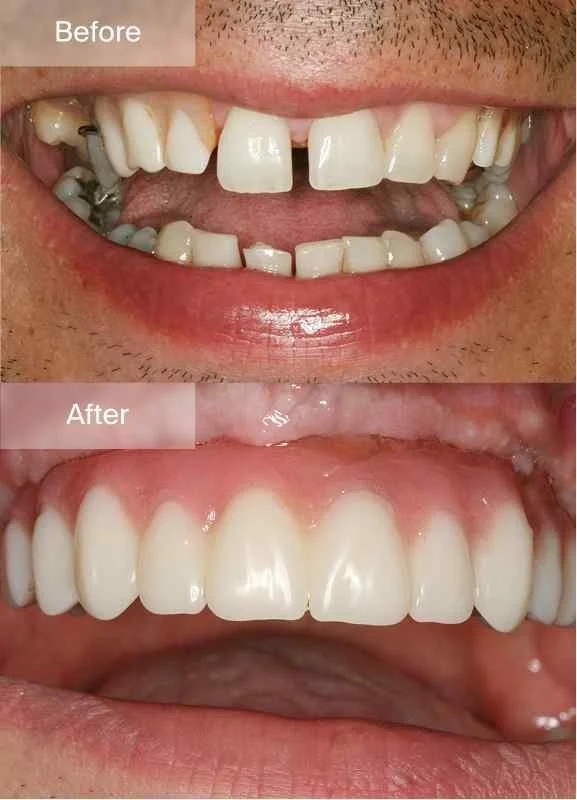 Full Mouth - Gallery - Image - 01.jpg