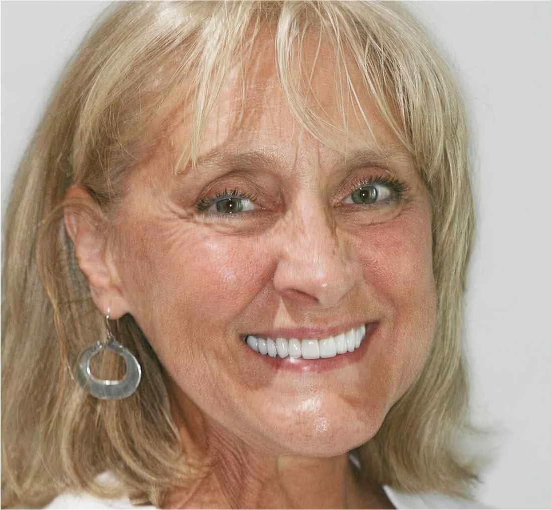 Cosmetic Gallery - Image - 04.jpg