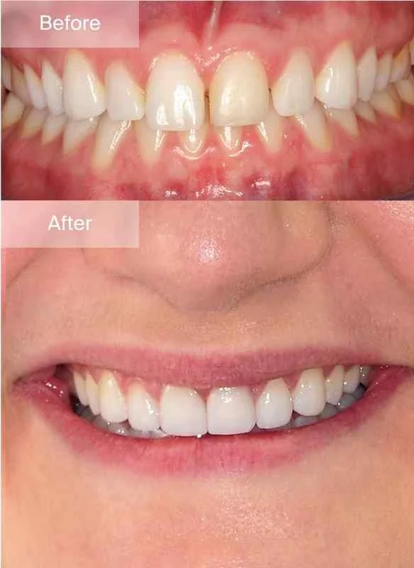 Cosmetic Gallery - Image - 01.jpg