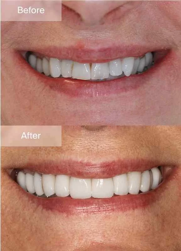 Cosmetic Gallery - Image - 03.jpg