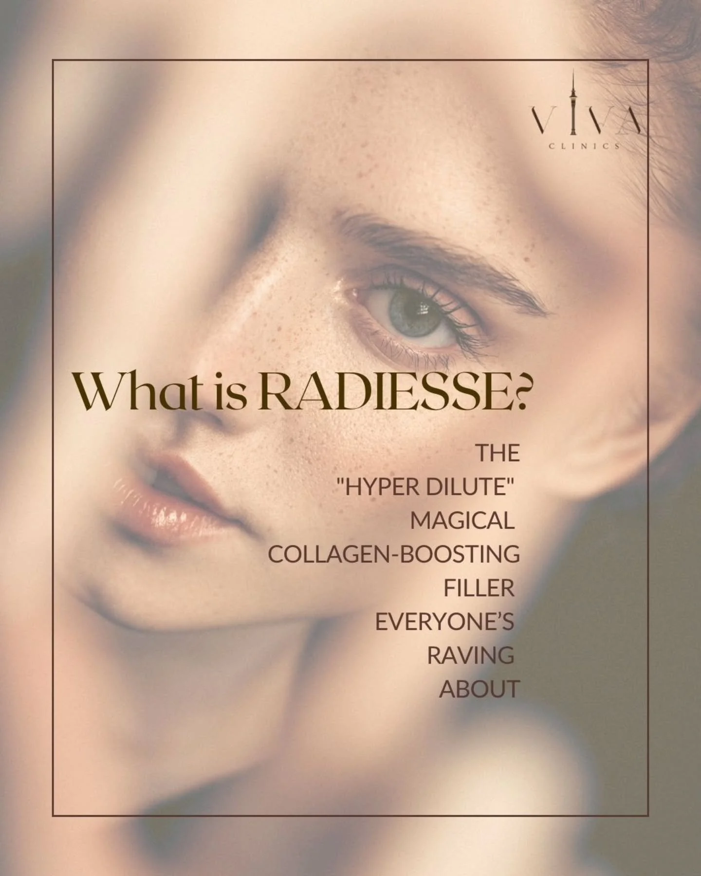Radiesse gives you that instant sculpt and keeps working behind the scenes.

Not your ordinary filler, stimulating collagen (for strength and structure), and elastin (for that bounce and snap your skin needs)

Over time, that means smoother texture, 