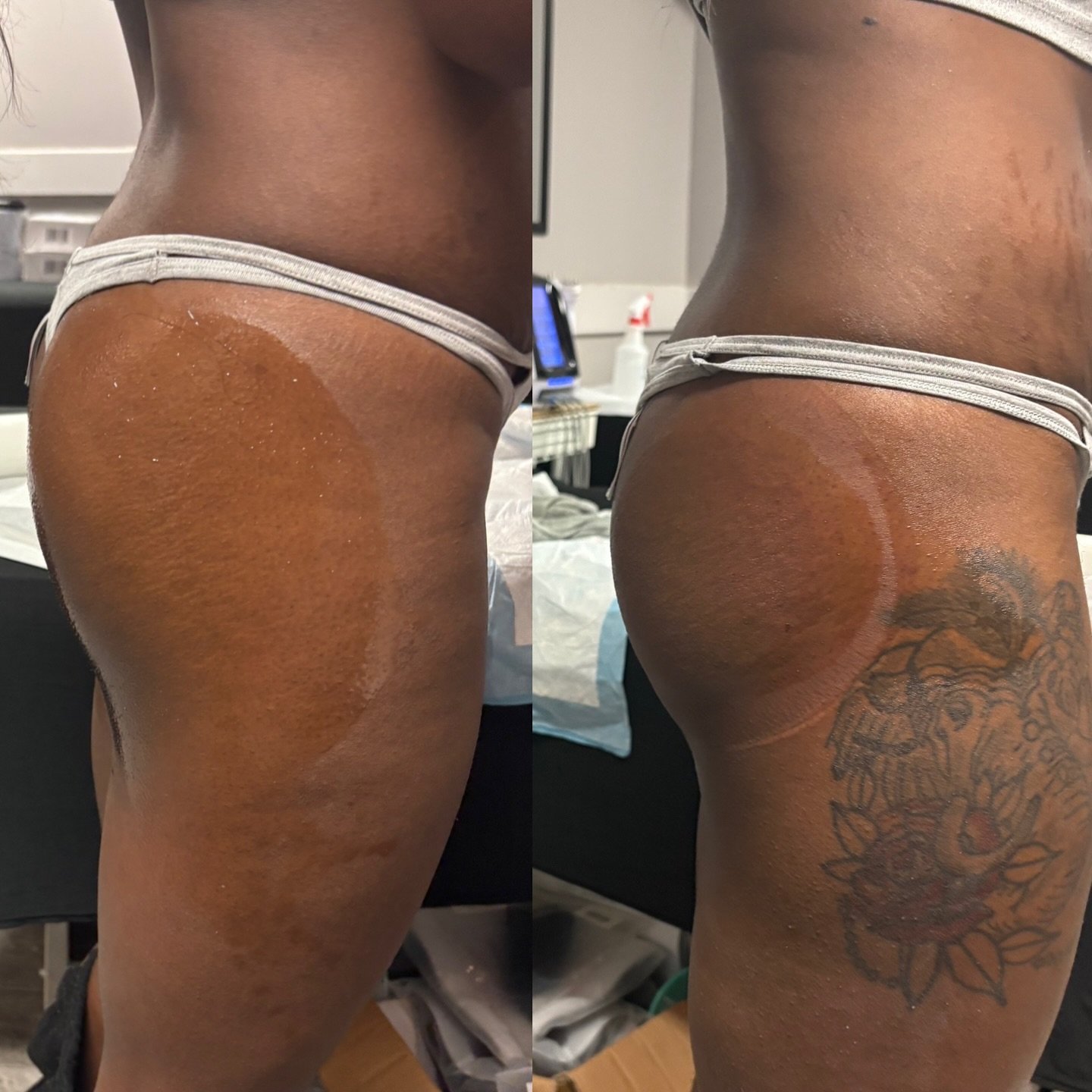 We make something out of nothing over here! Build booties, slim waists and tighten tummies all day everyday (except Wednesdays &amp; Sundays😌) almost 5 years in business my goodness 🙏🏽