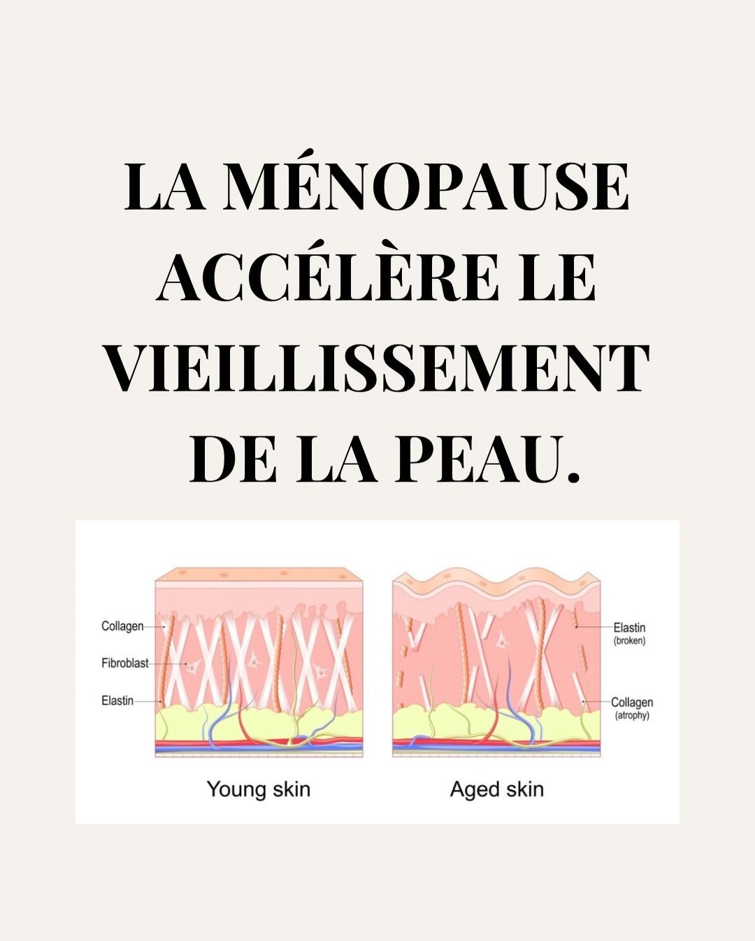 Le vieillissement de la peau s&rsquo;acc&eacute;l&egrave;re &agrave; la m&eacute;nopause pour une raison pr&eacute;cise :
la chute des &oelig;strog&egrave;nes.

En quelques ann&eacute;es, cela entra&icirc;ne :
	&bull;	une baisse rapide du collag&egra