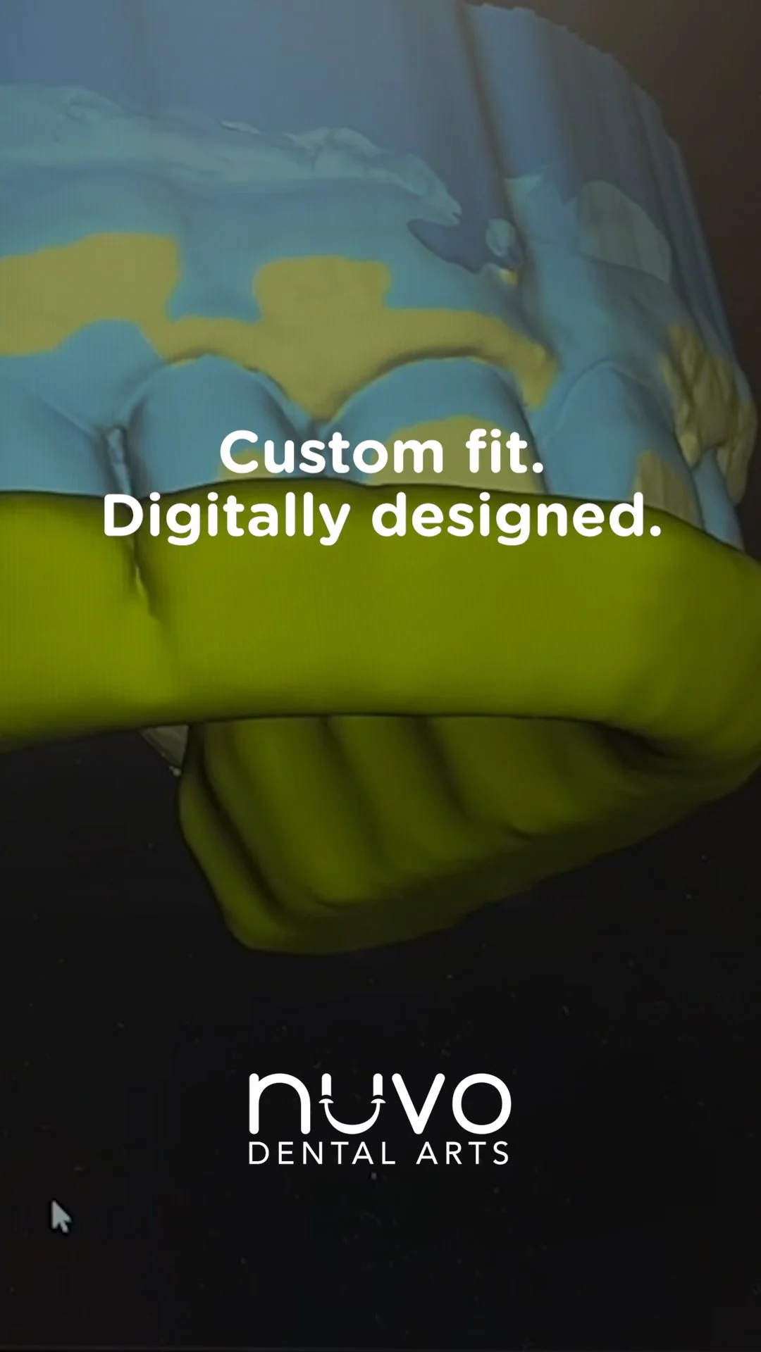 Digitally Designed Night Guards in Coral Gables and Coconut Grove