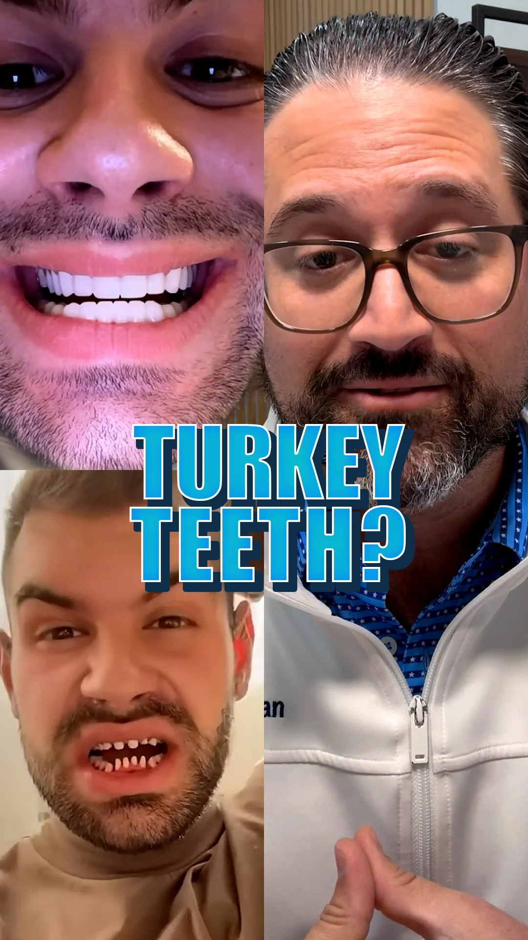 Turkey Teeth vs. Proper Smile Design in Coral Gables