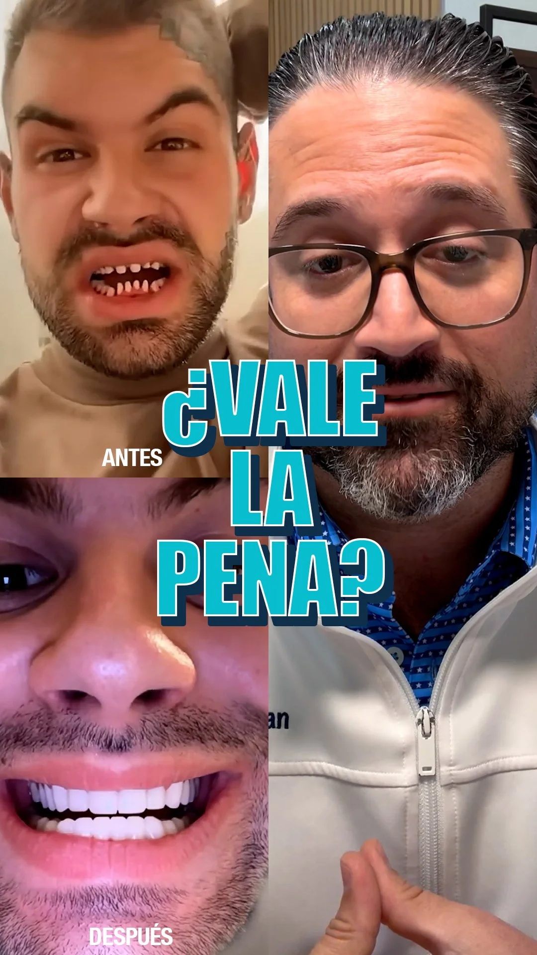 ¿Son Seguros los “Dientes de Turcos”? | Dentista en Miami Explica