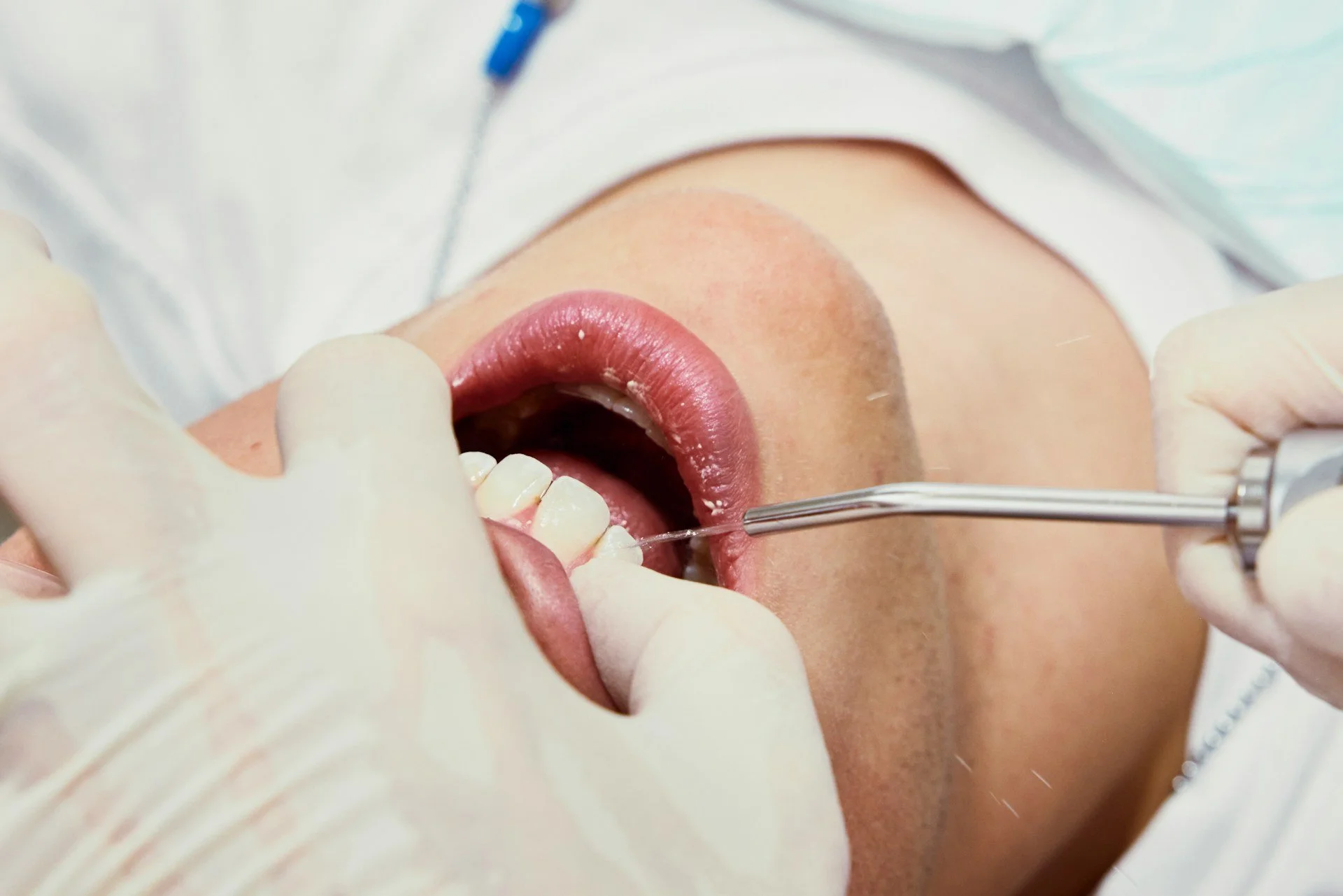 What a Dental Checkup in Miami Looks Like in One Calm Visit