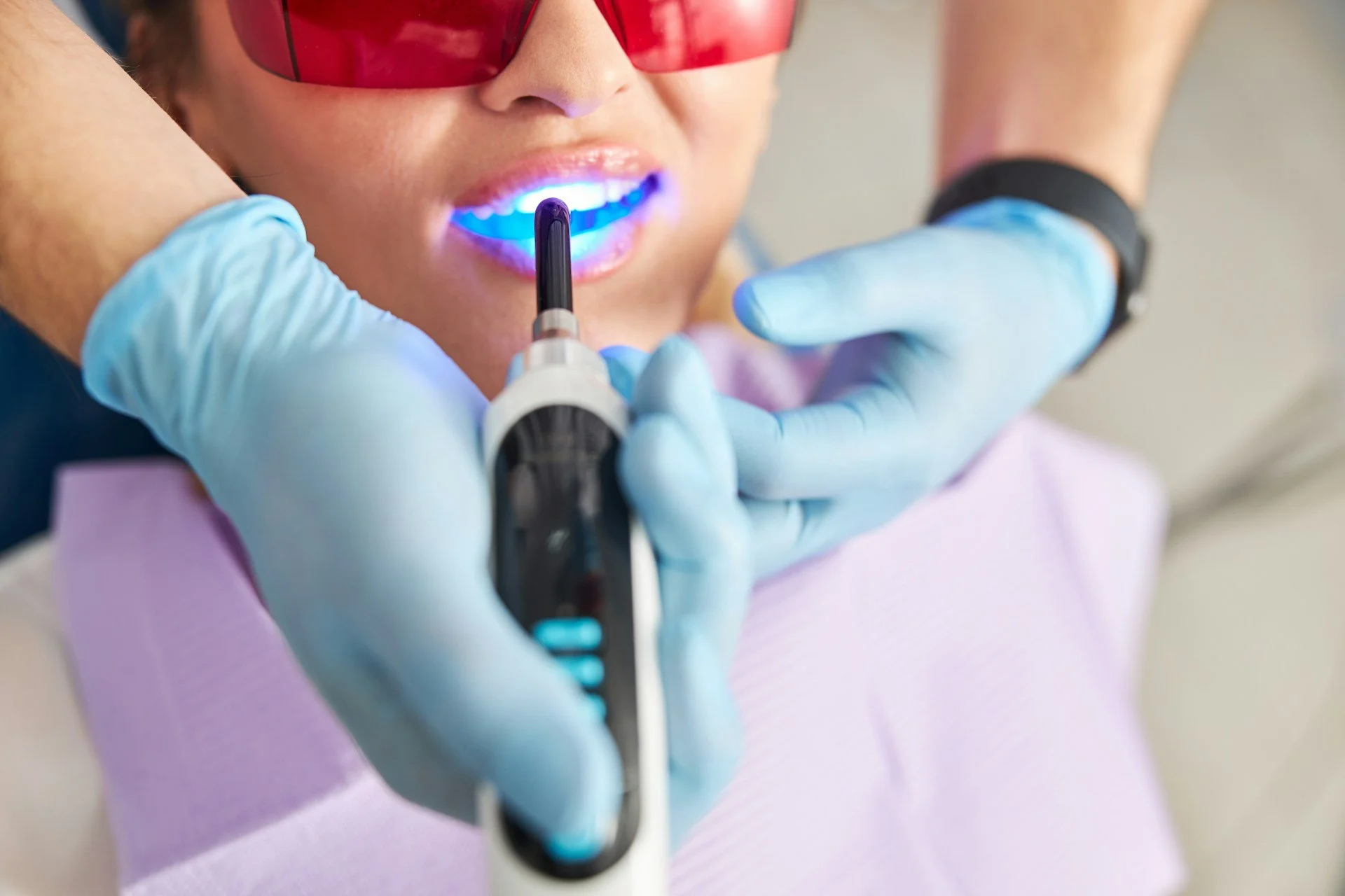Everyday Habits That Quietly Undo Your Teeth Whitening in Miami