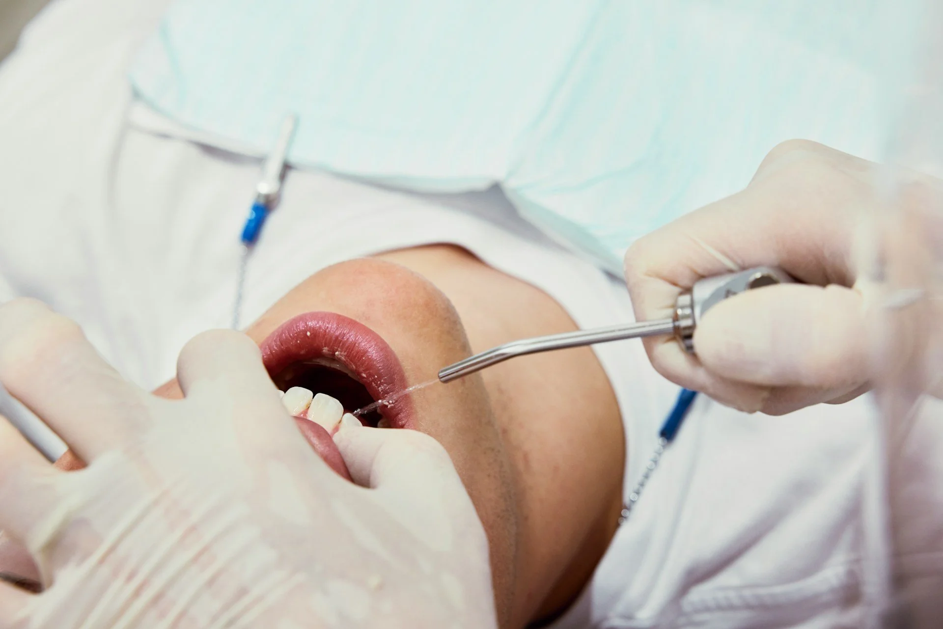 Your First Dental Cleaning in Coconut Grove: Steps, Time, and Aftercare