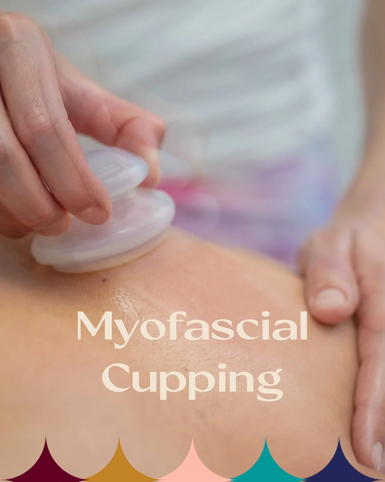The people have spoken, and Myofascial Cupping is back! 
It's a love-it-or-hate-it kind of thing - some love the amplified massage benefits, while others aren't fans of the temporary marks. Which side are you on? 
Ready to try it out? Just add the My