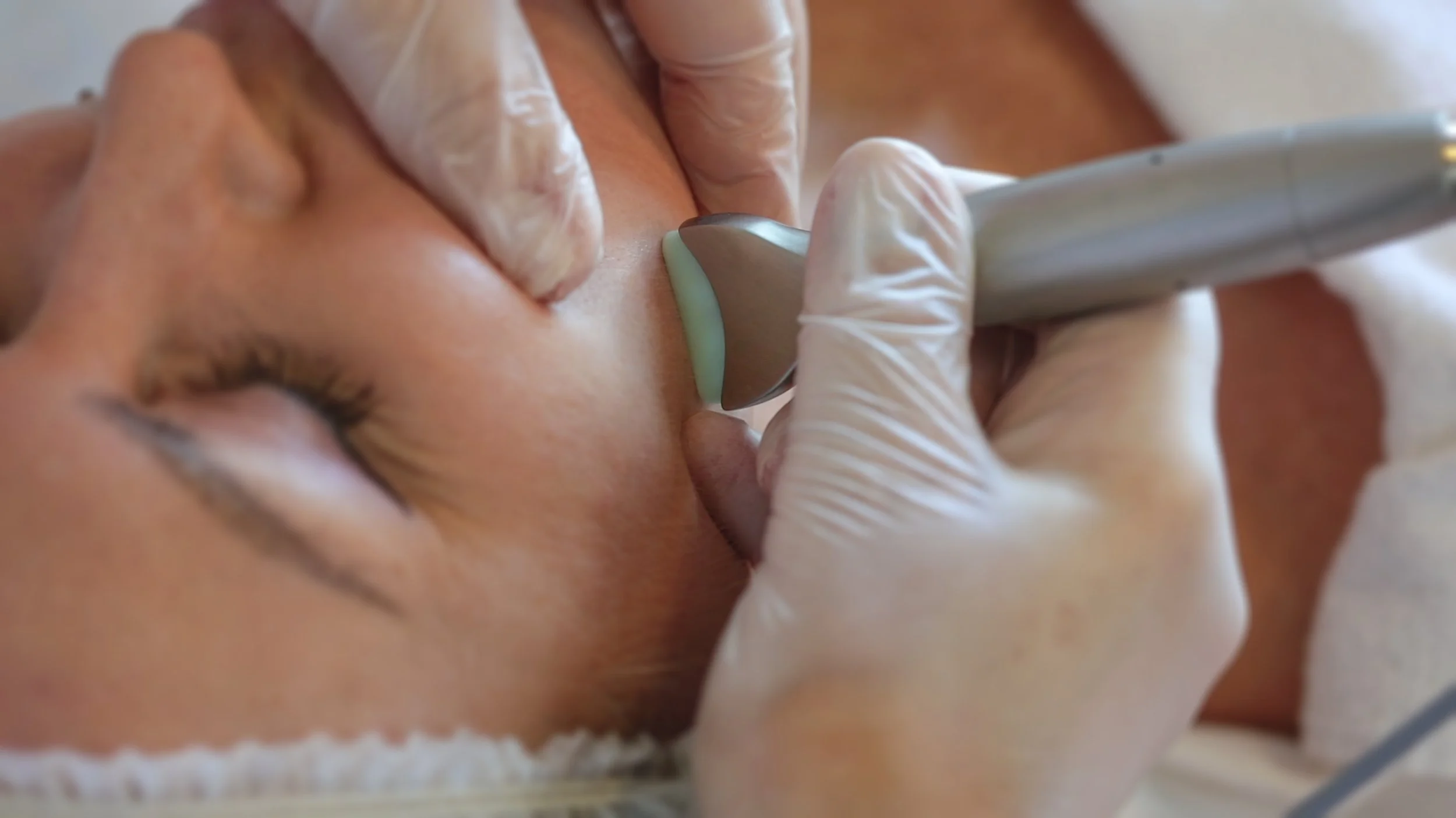 Shibata M Activation