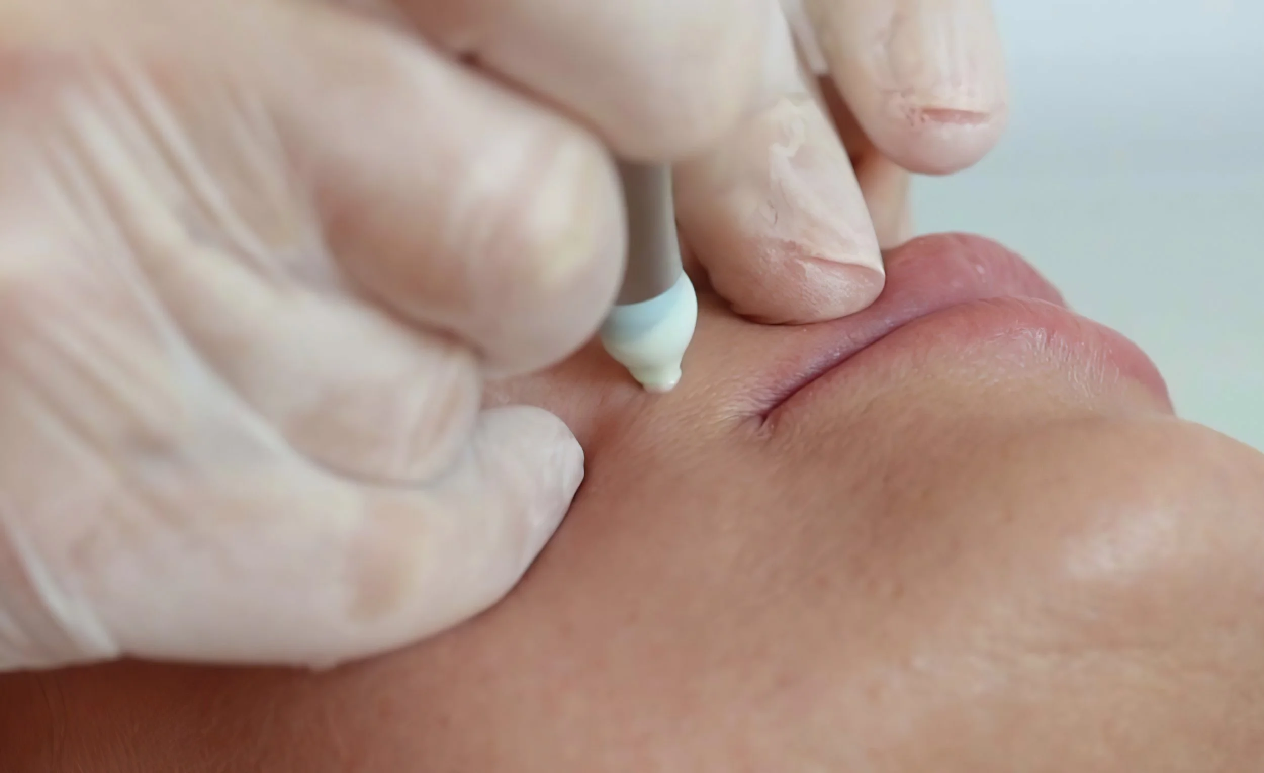 Shibata S Activation 