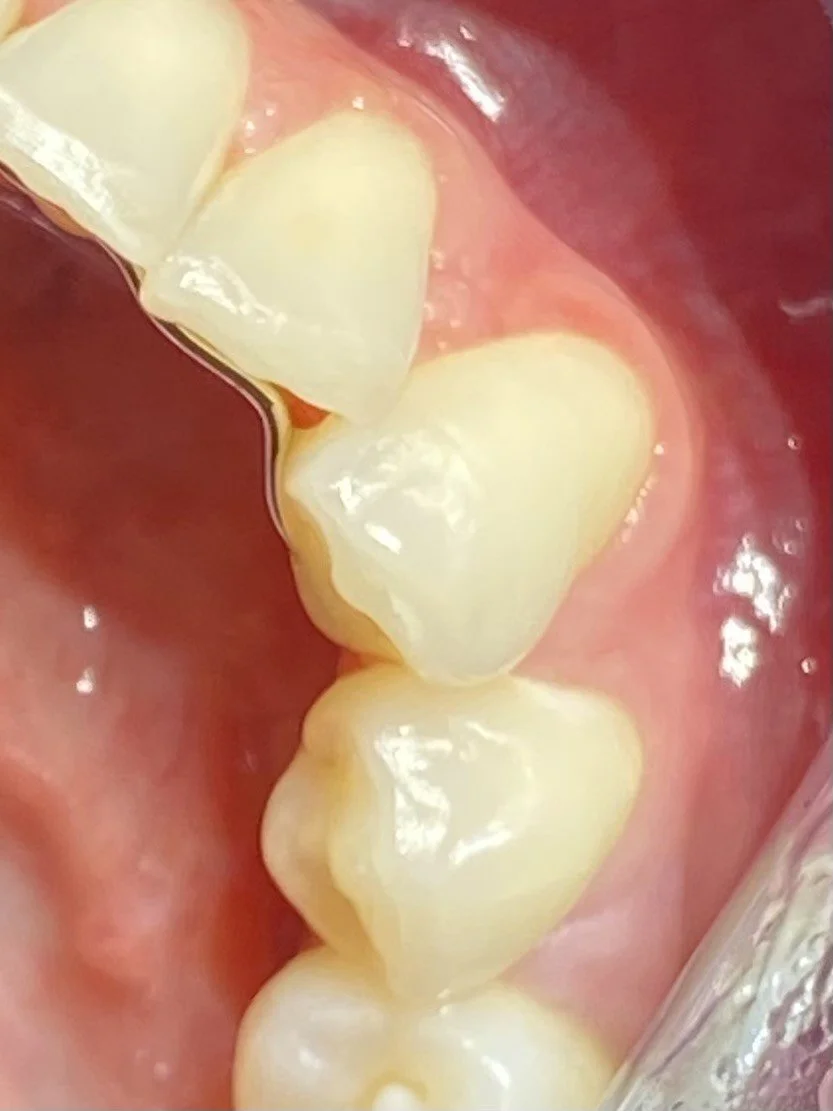 Close-up of human molars and gum
