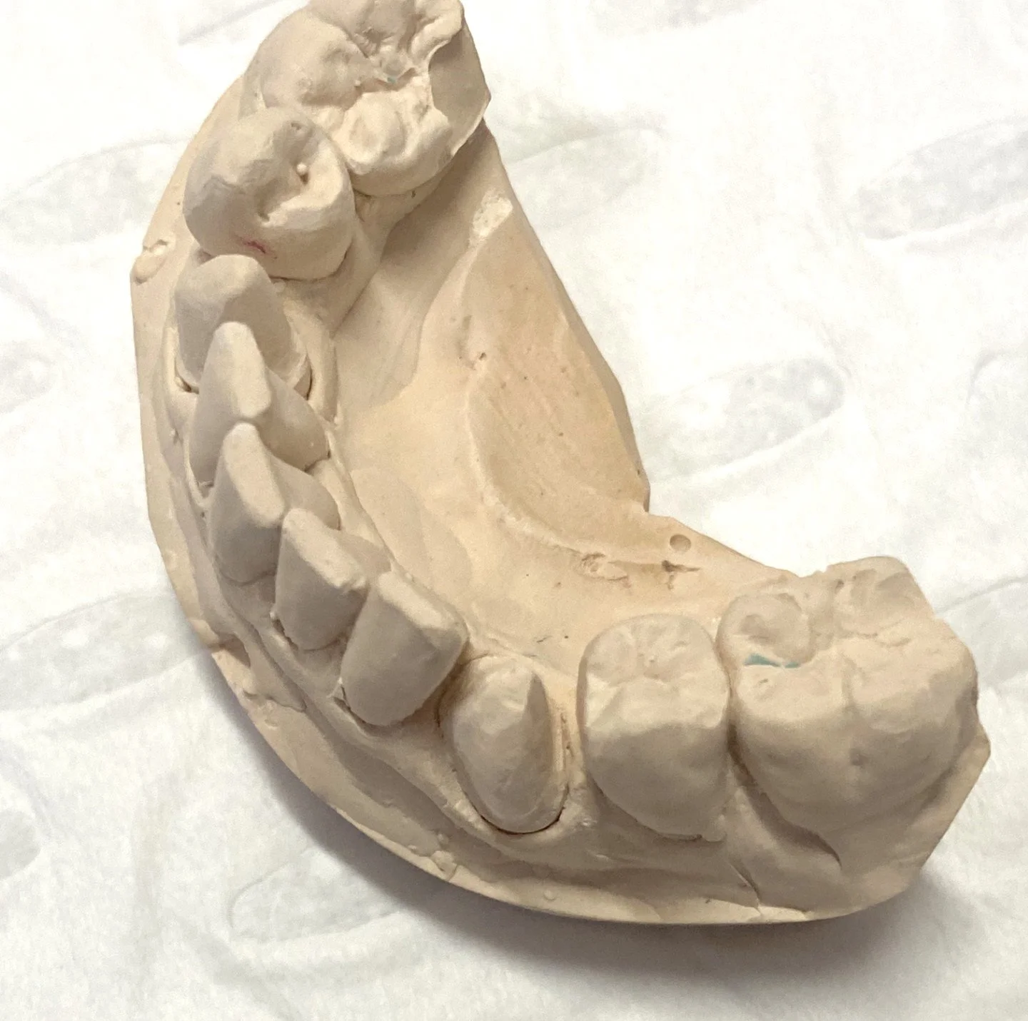 Dental plaster model of human teeth