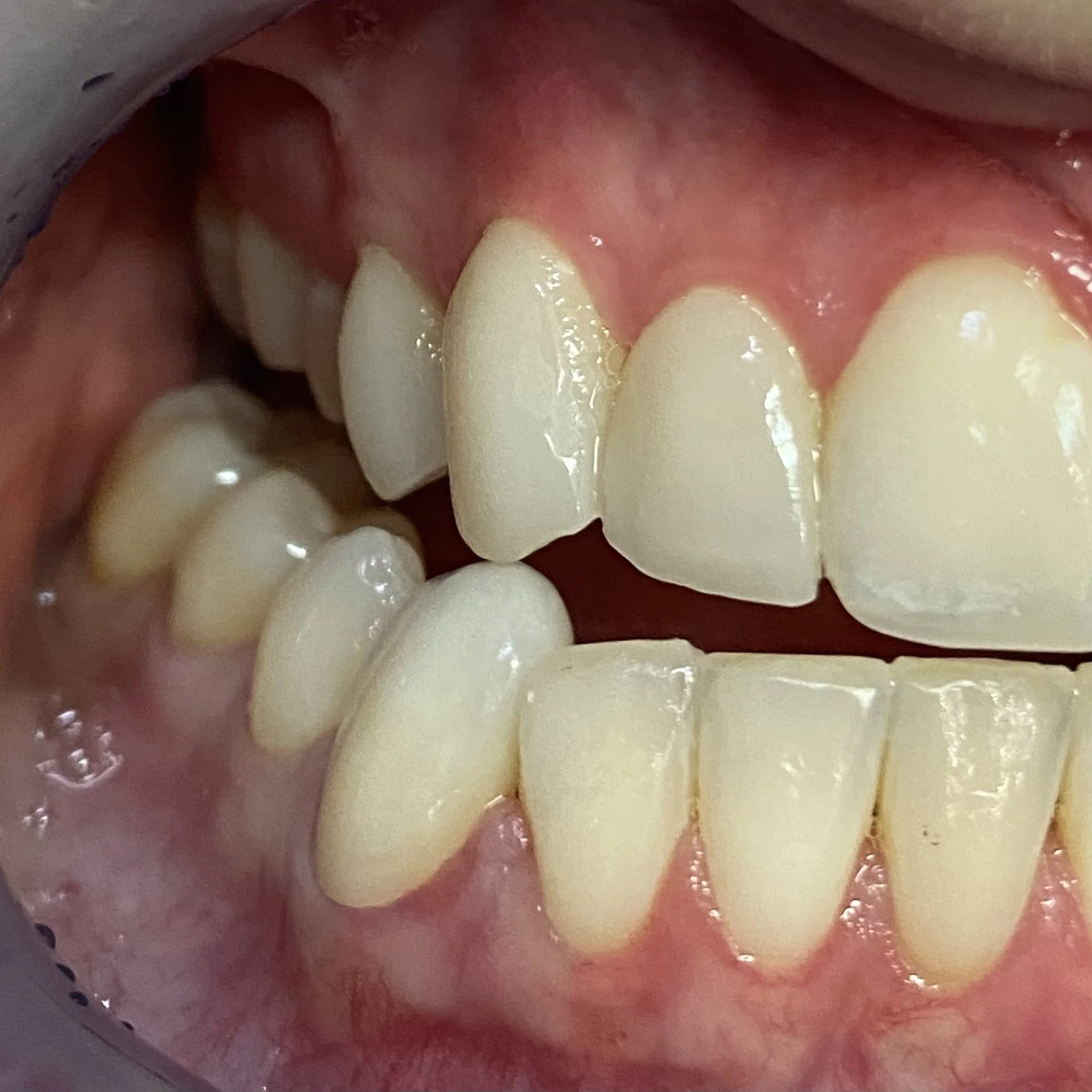 Close-up of human teeth and gums