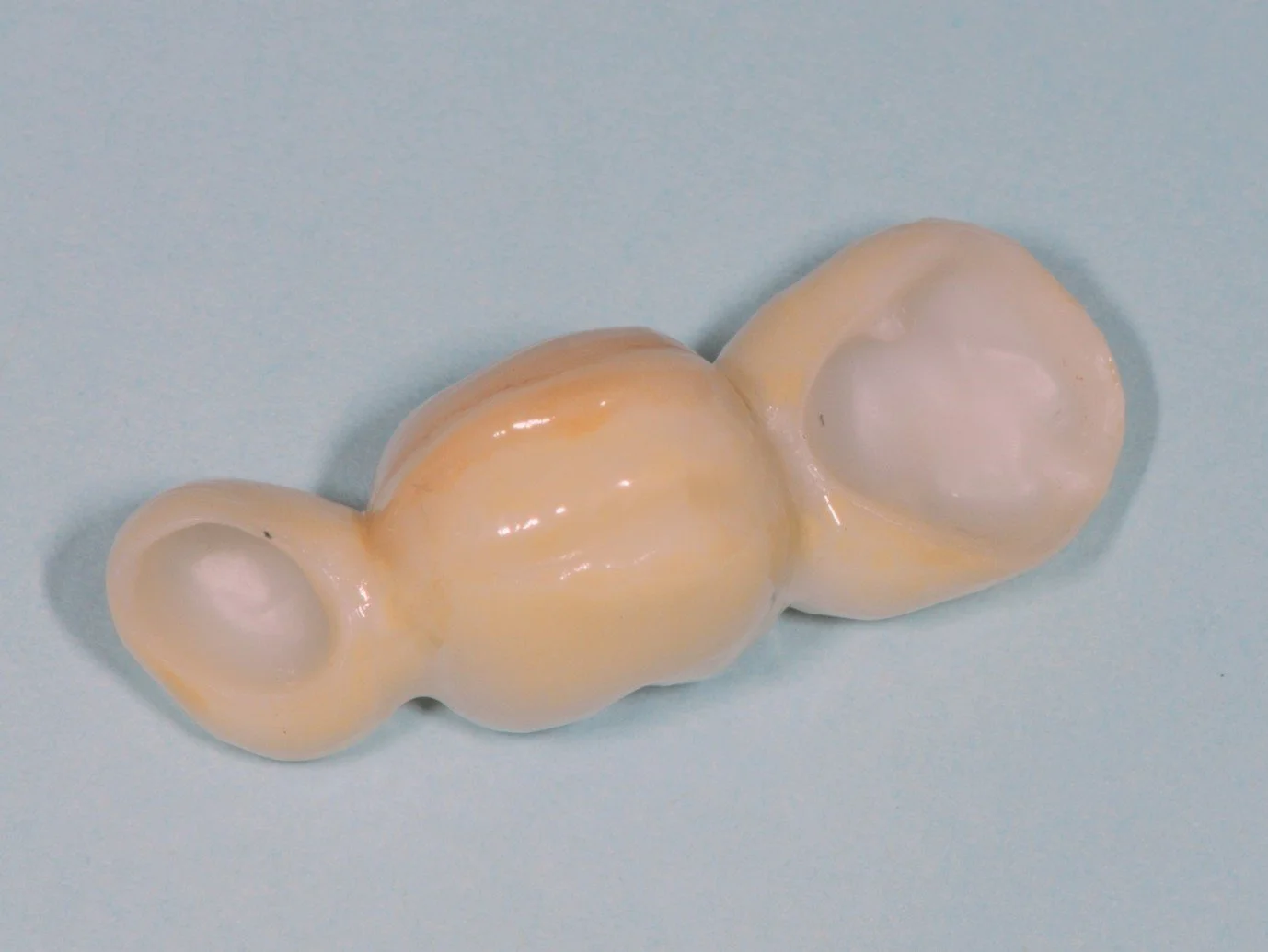 Dental bridge on light blue background