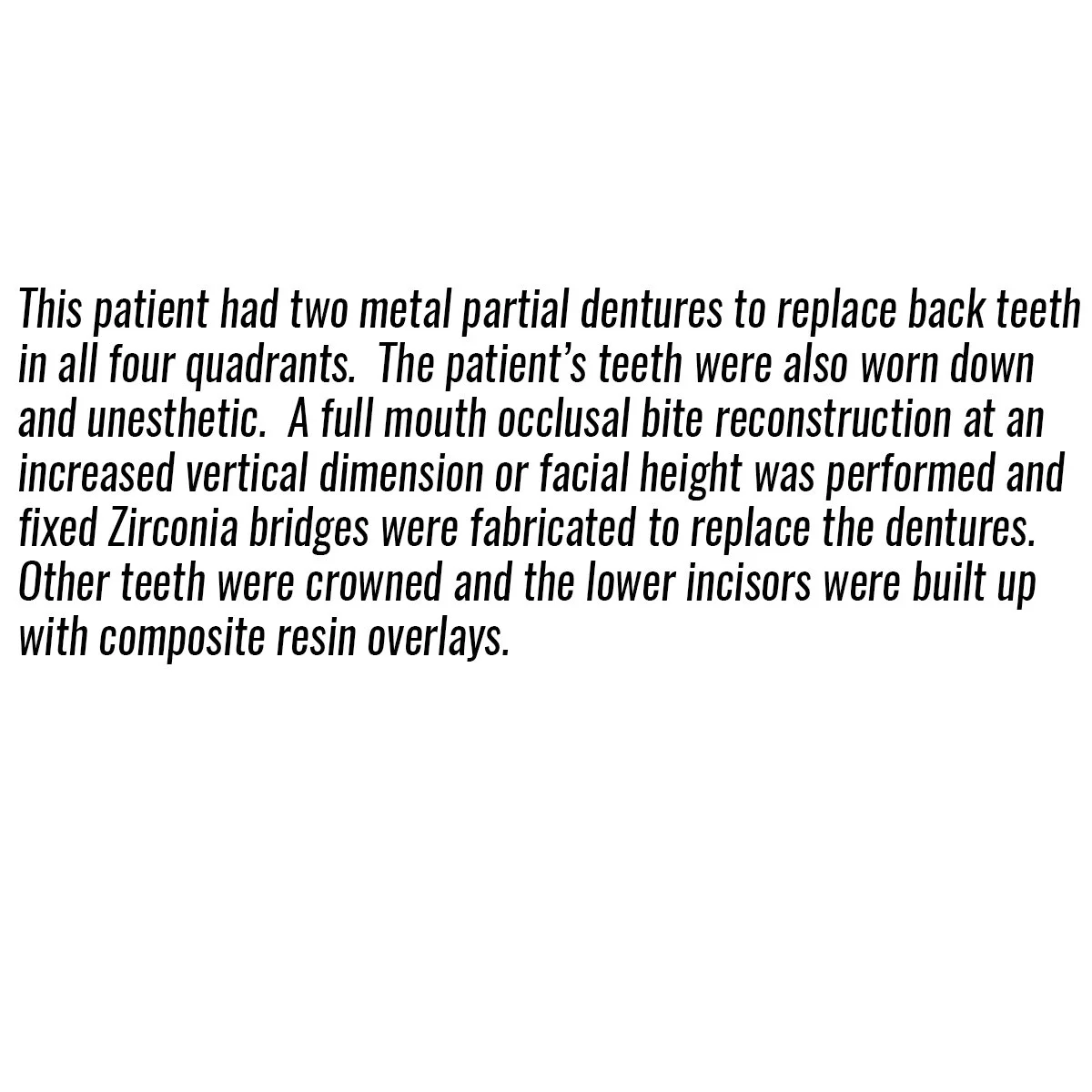 Text description of dental procedures including metal partial dentures, occlusal bite reconstruction, Zirconia bridges, crowning, and composite resin overlays for lower incisors.