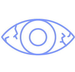Stylized eye icon representing dry eye symptoms and ocular irritation treated at Intown Dry Eye Care in Decatur, GA.