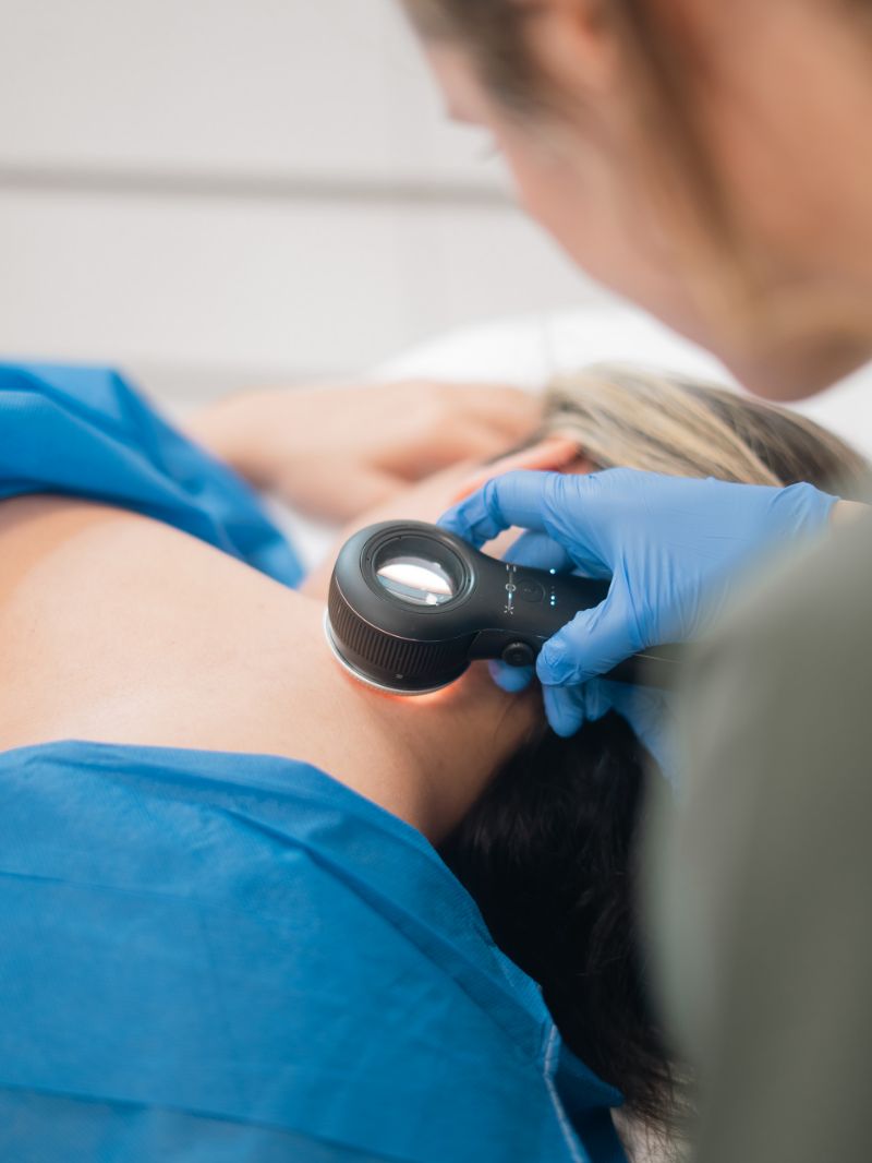 What’s that Bump? Common Skin Lesions Explained